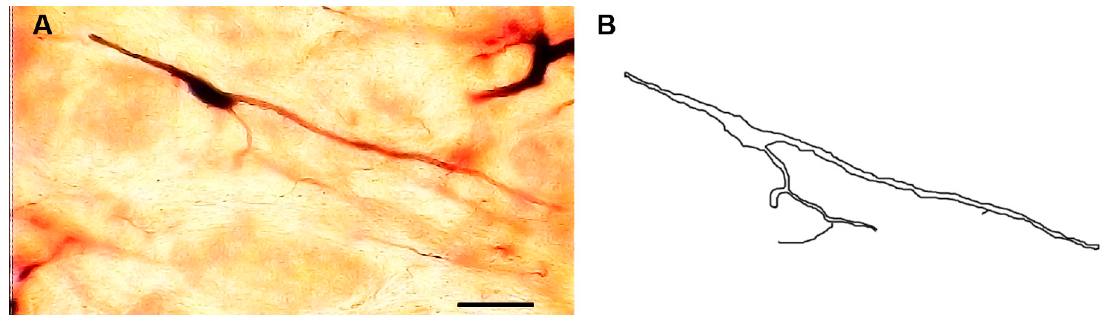 Brainsci 13 00312 g004