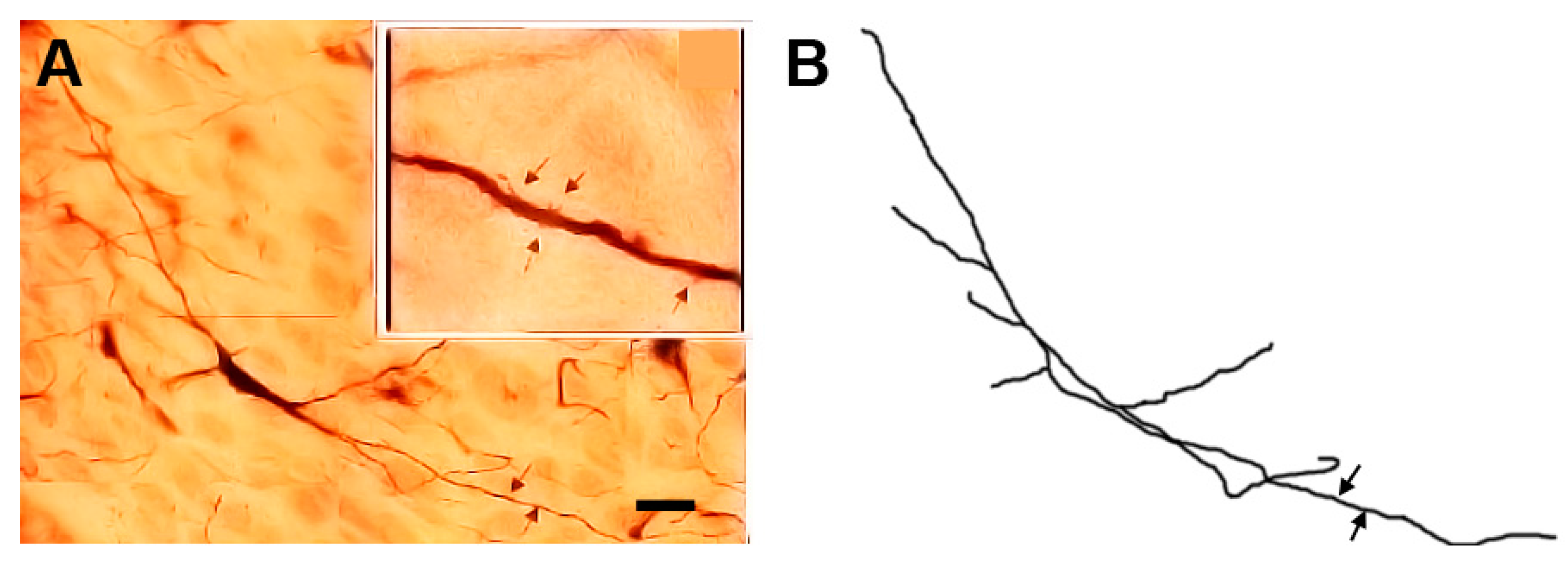 Brainsci 13 00312 g006