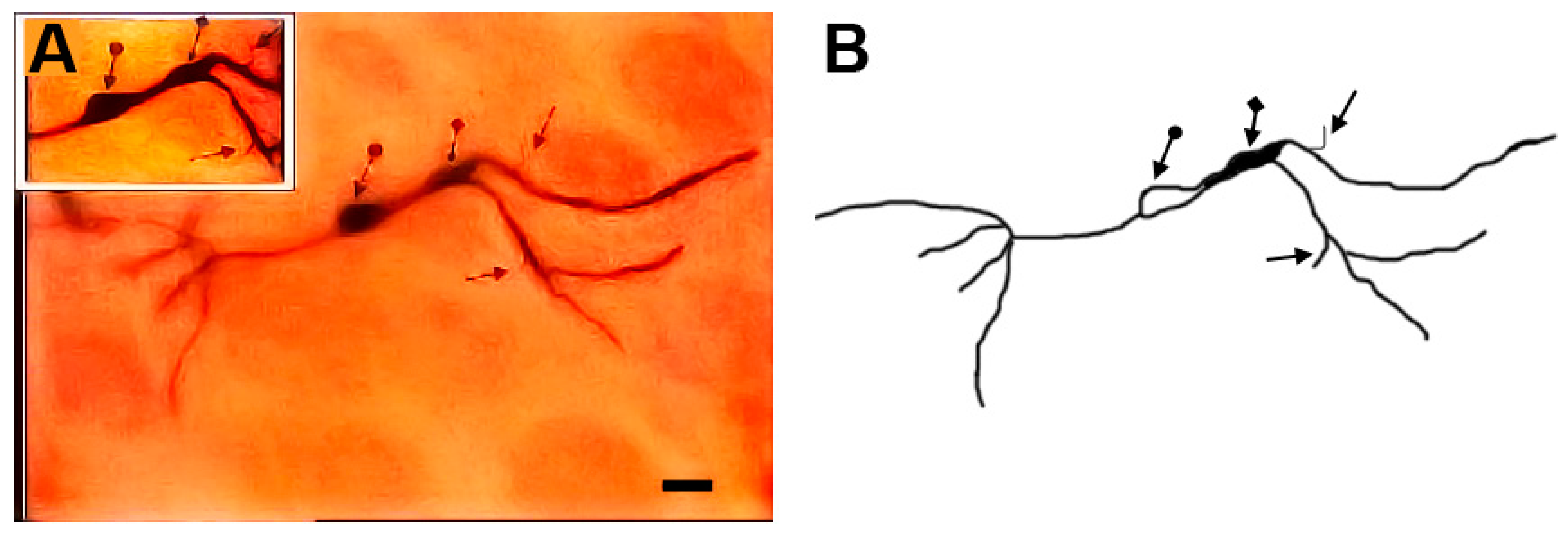 Brainsci 13 00312 g011