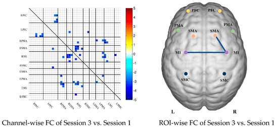 Brainsci 13 00338 g002b