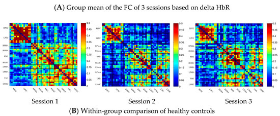 Brainsci 13 00338 g003a Brainsci 13 00338 g003a