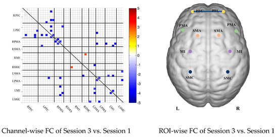 Brainsci 13 00338 g003b