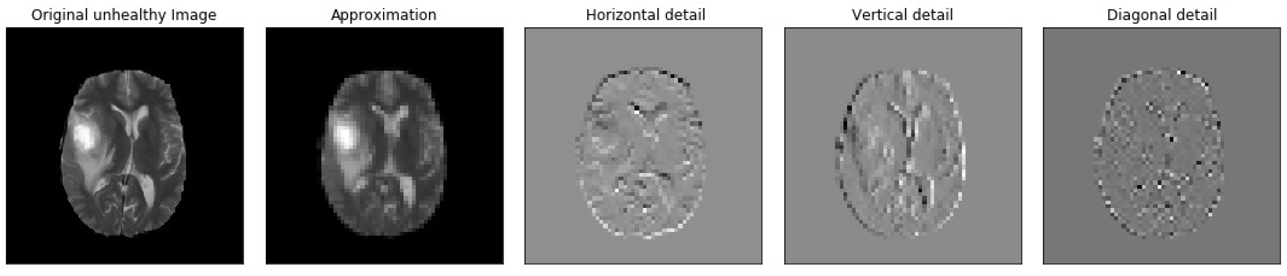 Brainsci 13 00348 g006