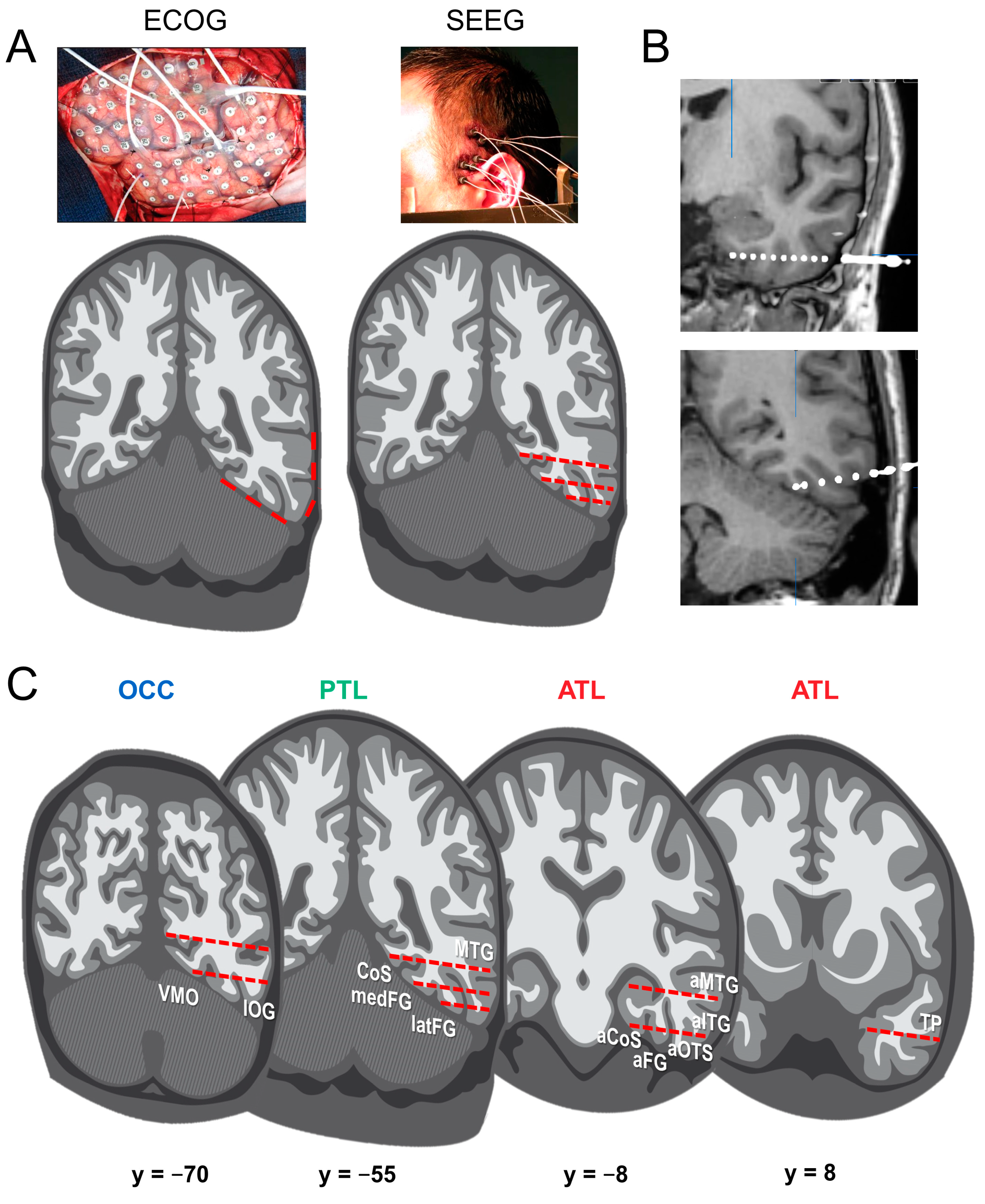 Brainsci 13 00354 g001