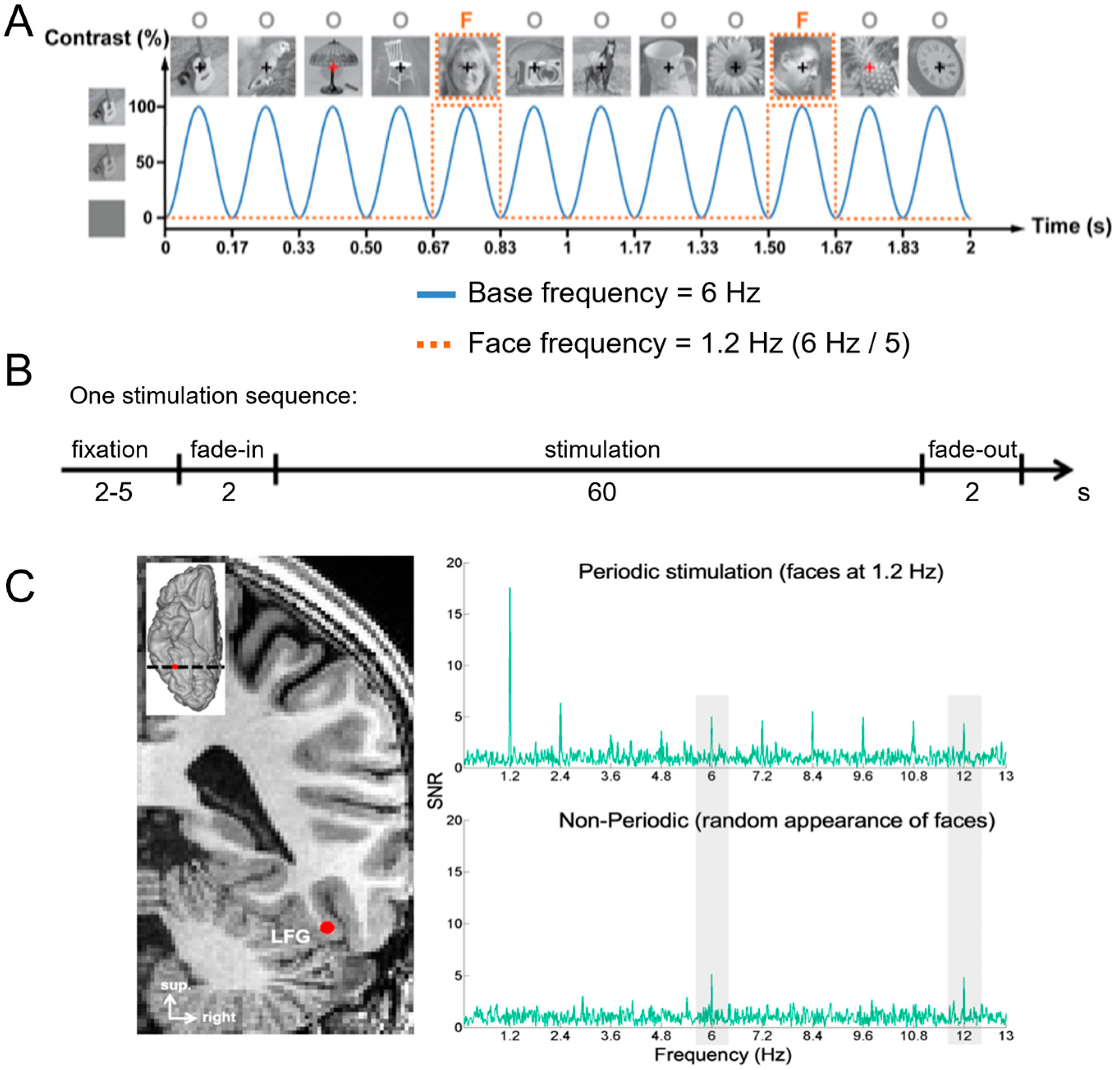 Brainsci 13 00354 g002