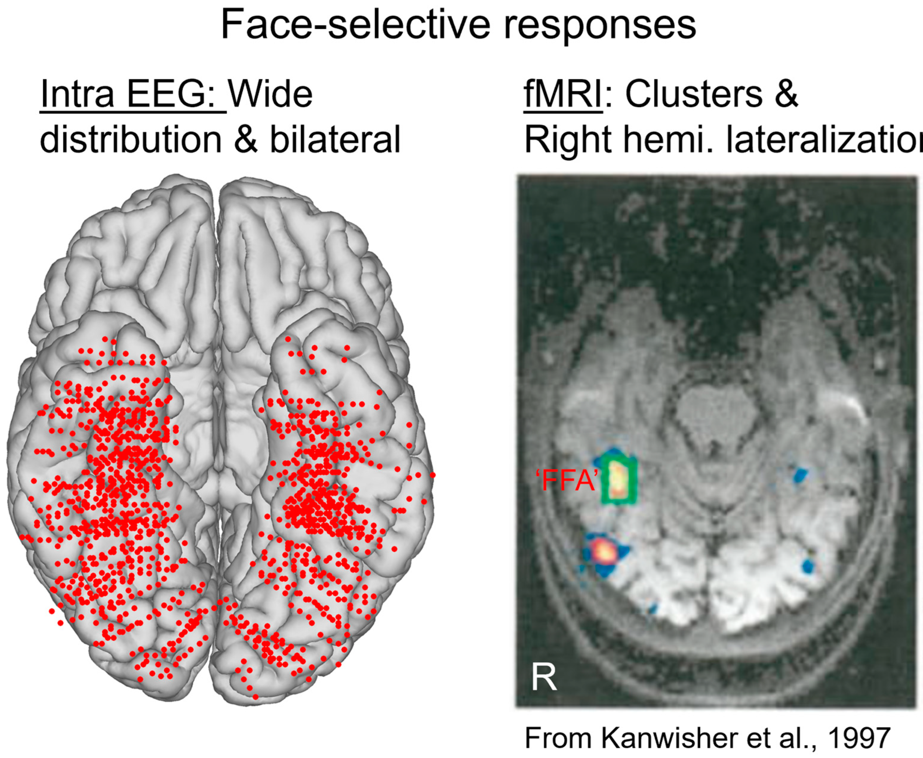 Brainsci 13 00354 g004