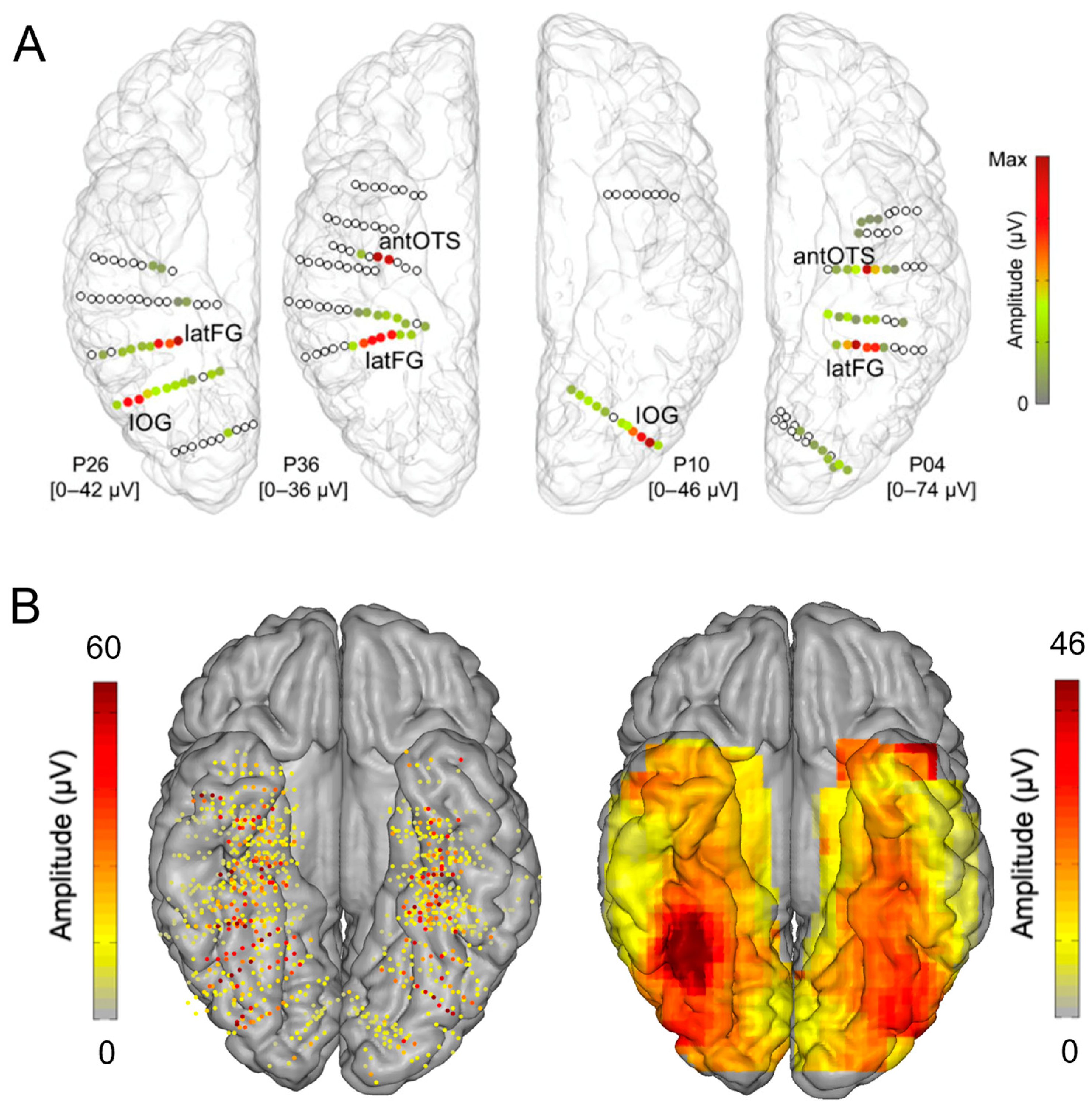 Brainsci 13 00354 g006