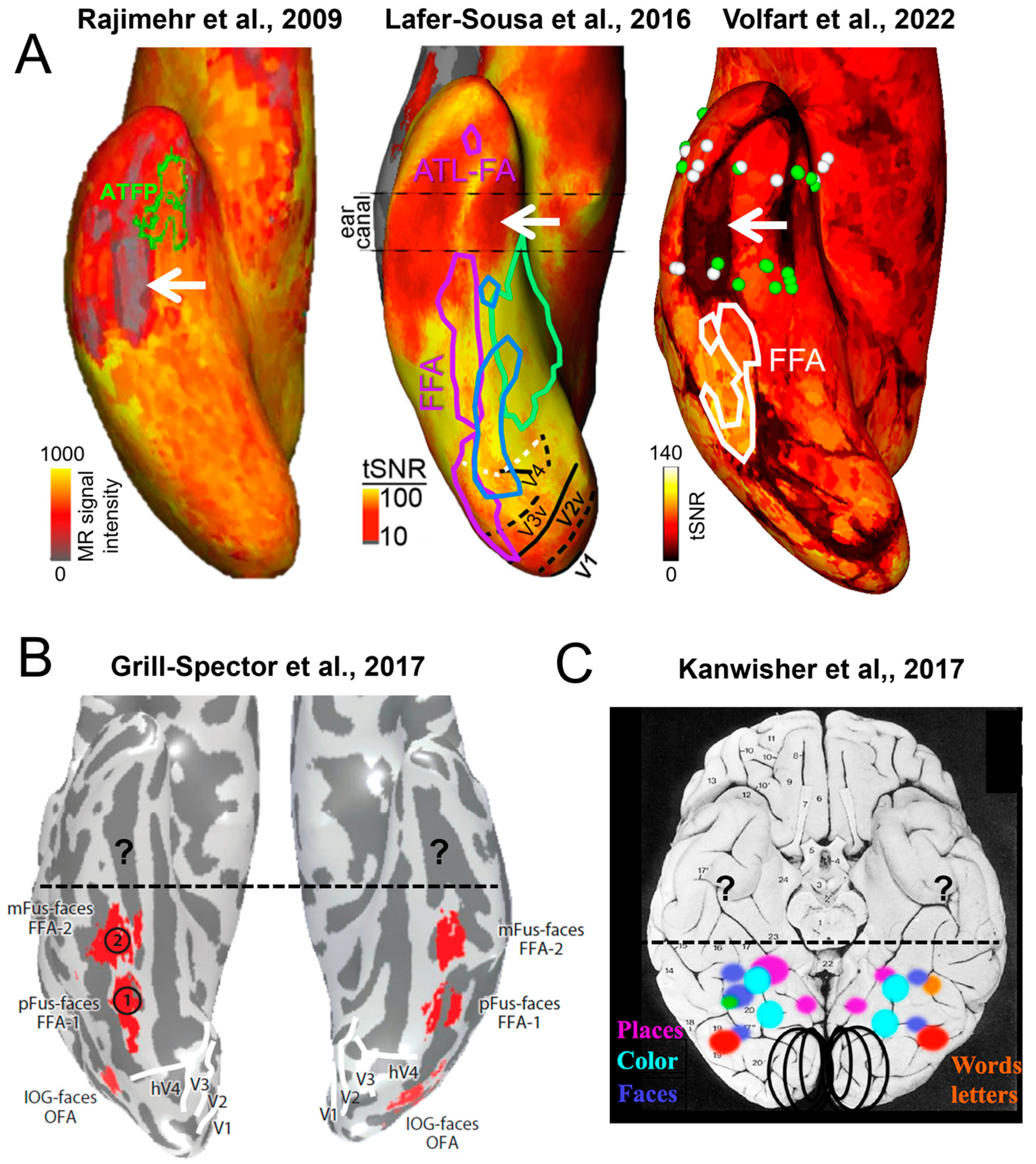 Brainsci 13 00354 g007