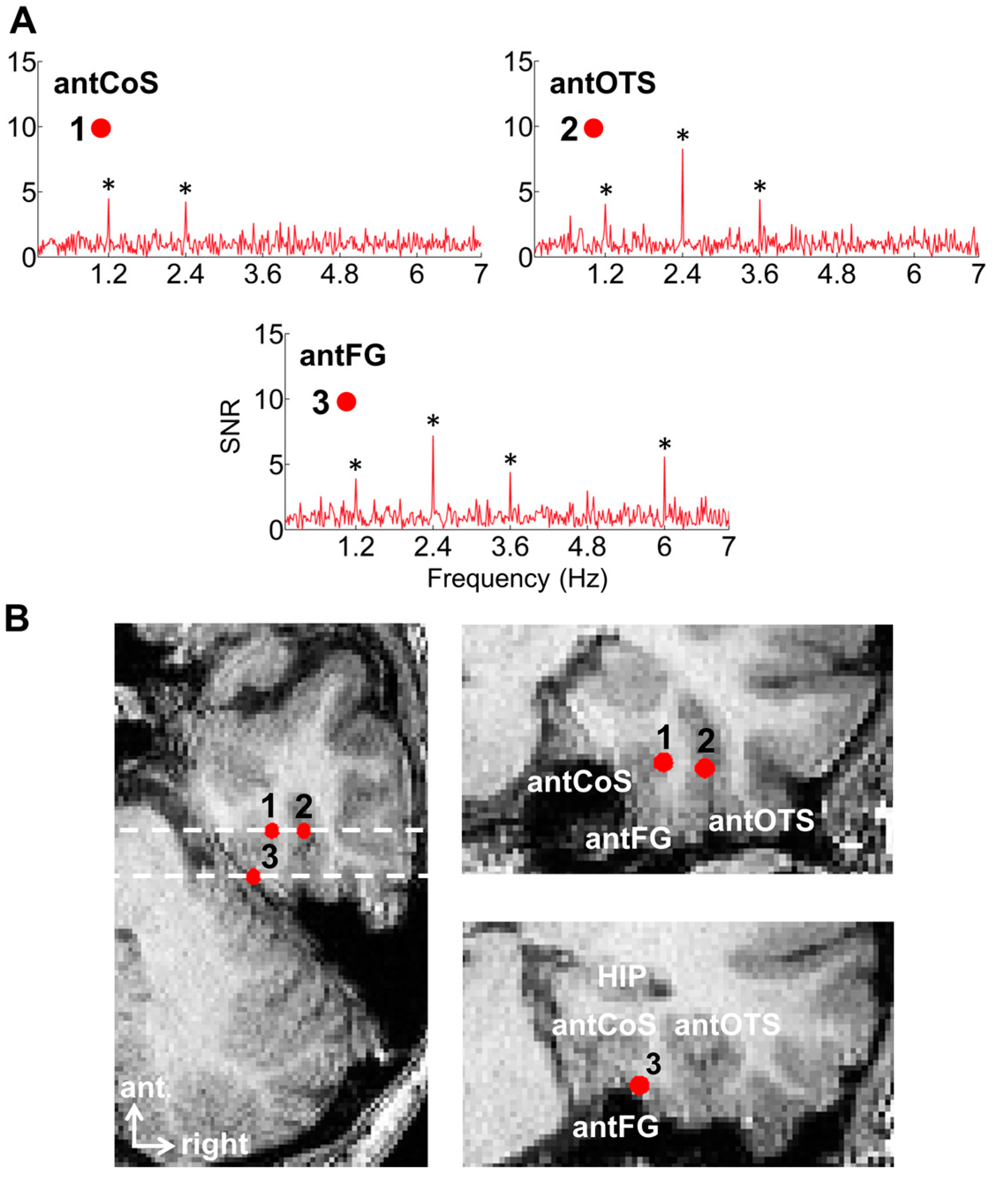 Brainsci 13 00354 g008