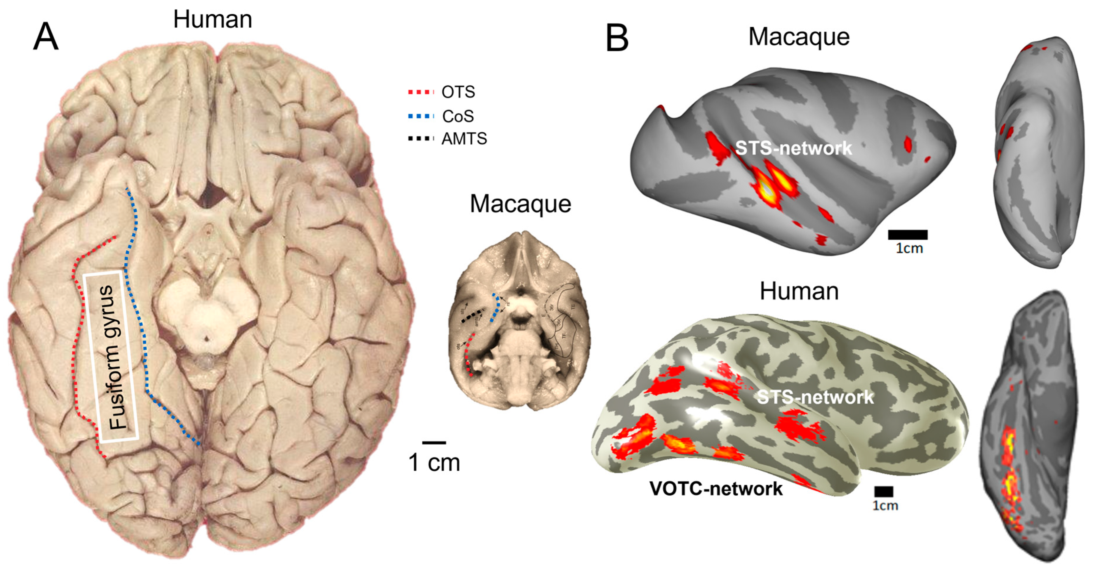 Brainsci 13 00354 g009