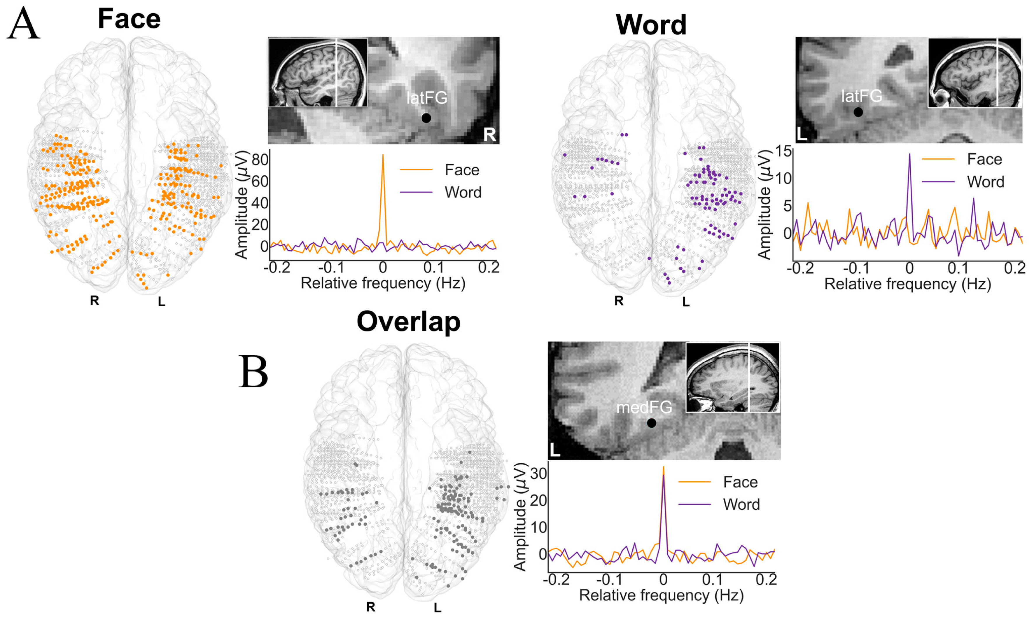 Brainsci 13 00354 g013