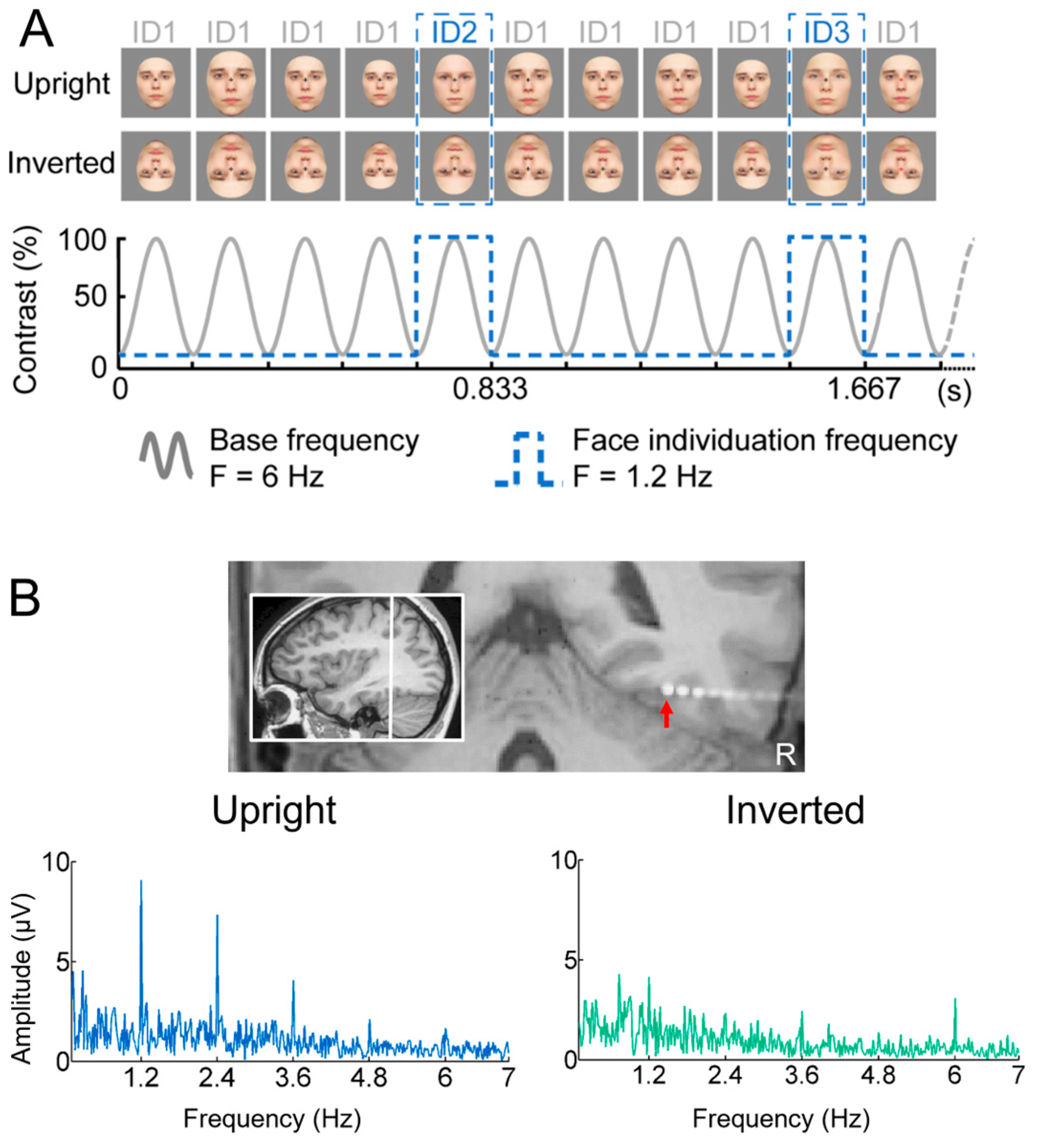 Brainsci 13 00354 g016