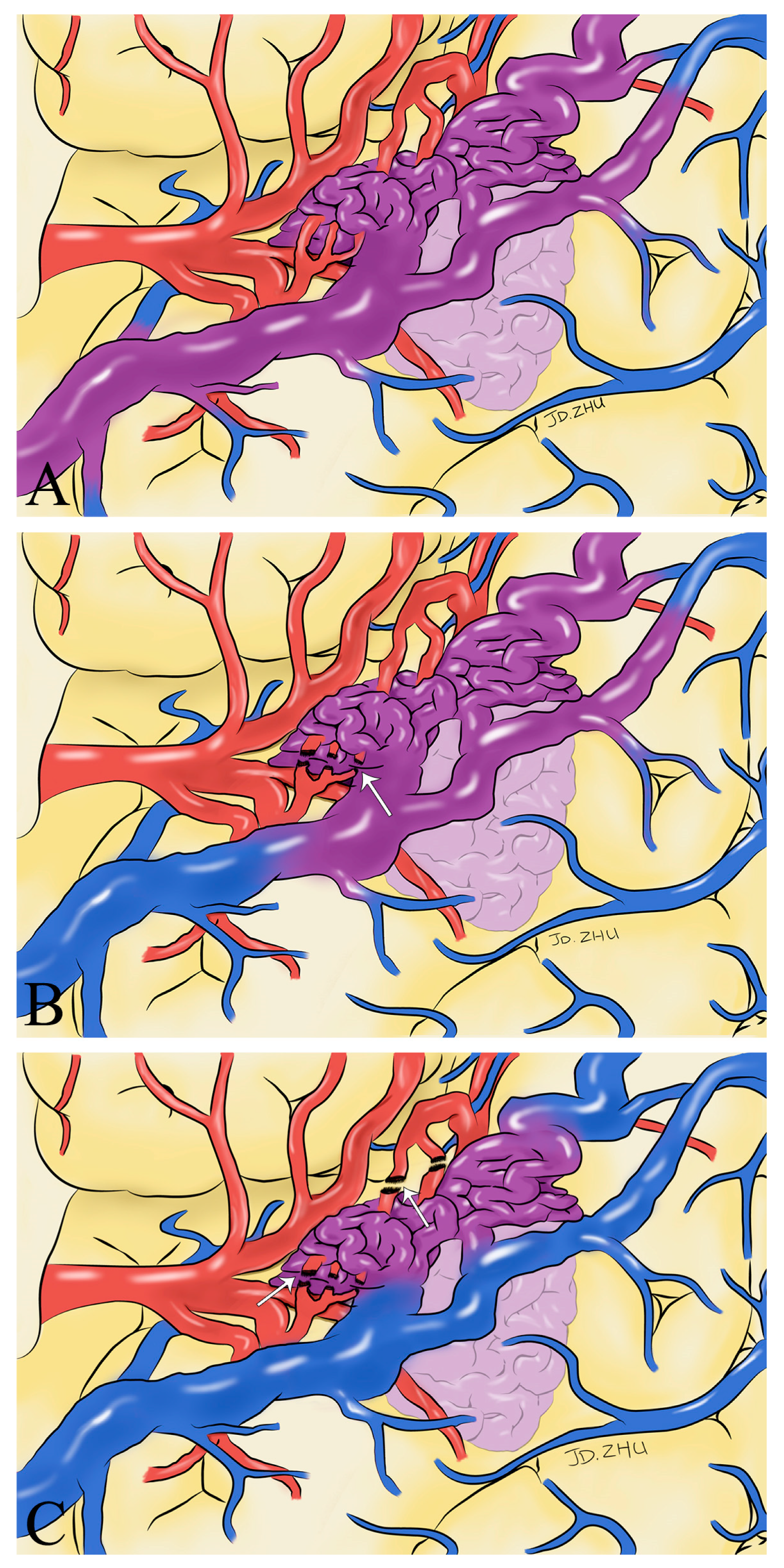 Brainsci 13 00366 g006