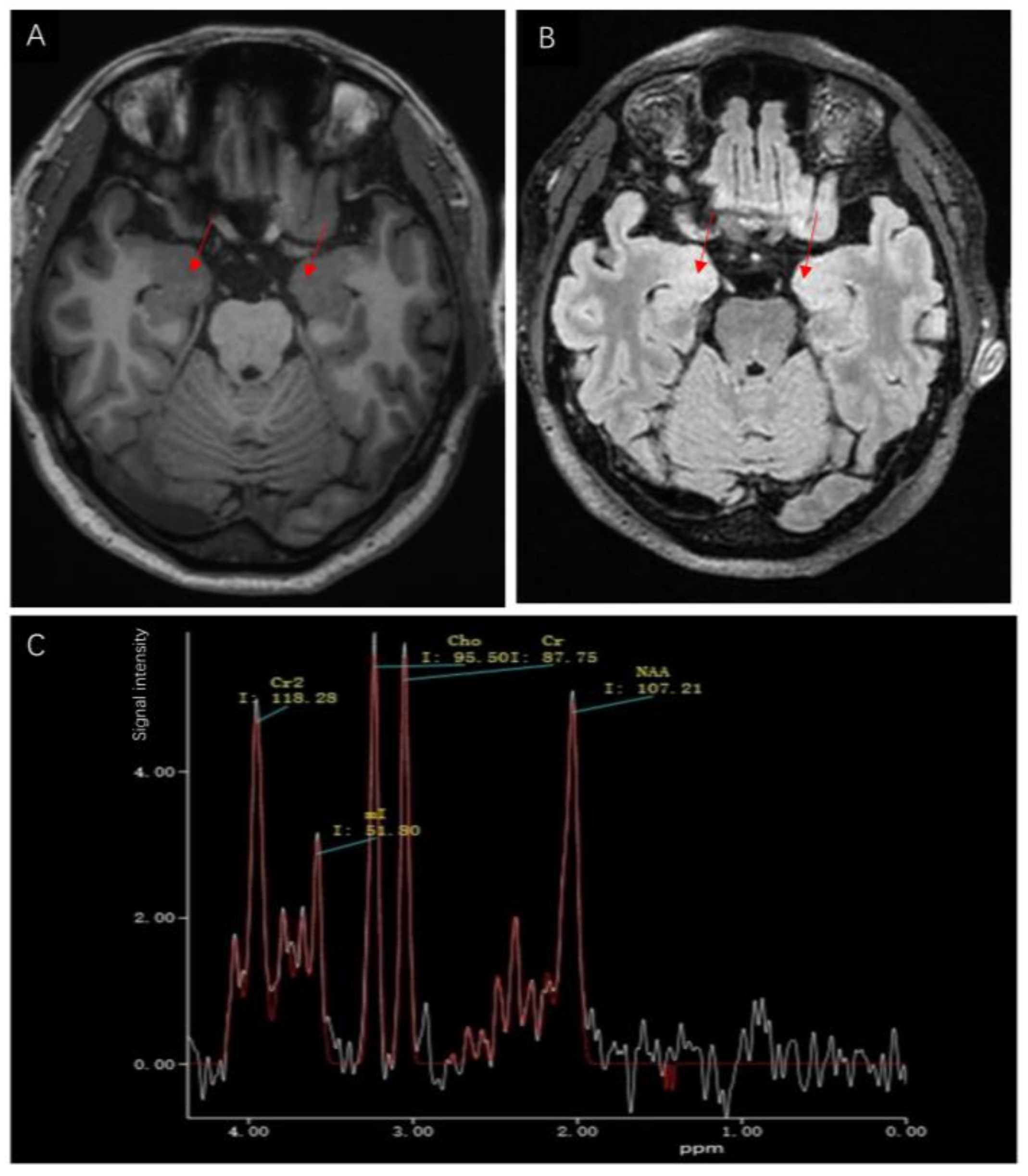 Brainsci 13 00369 g001 Brainsci 13 00369 g001