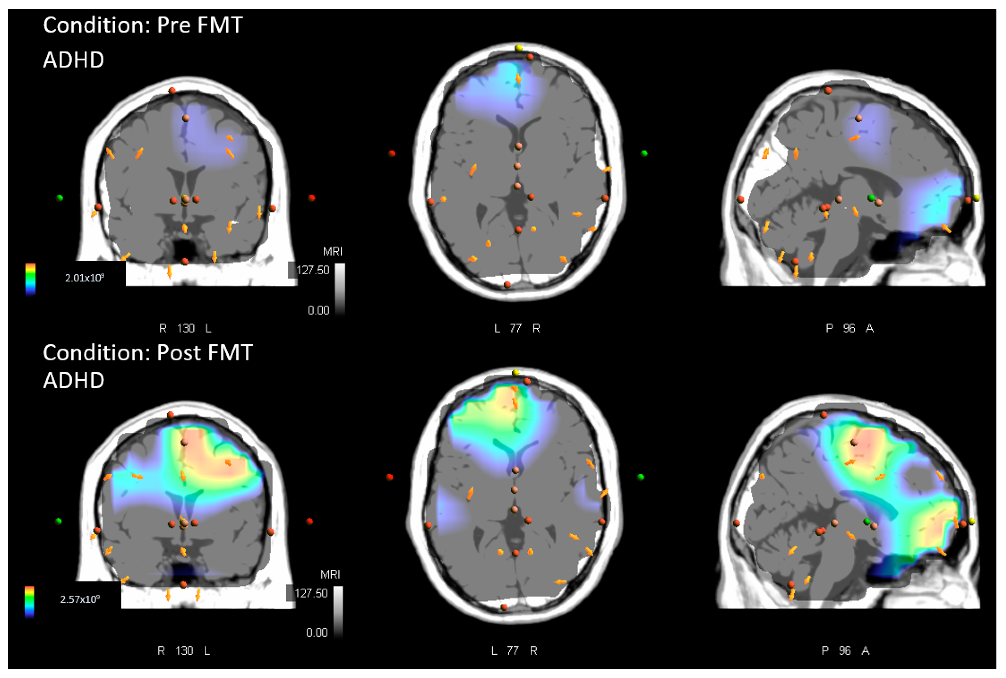 Brainsci 13 00370 g003
