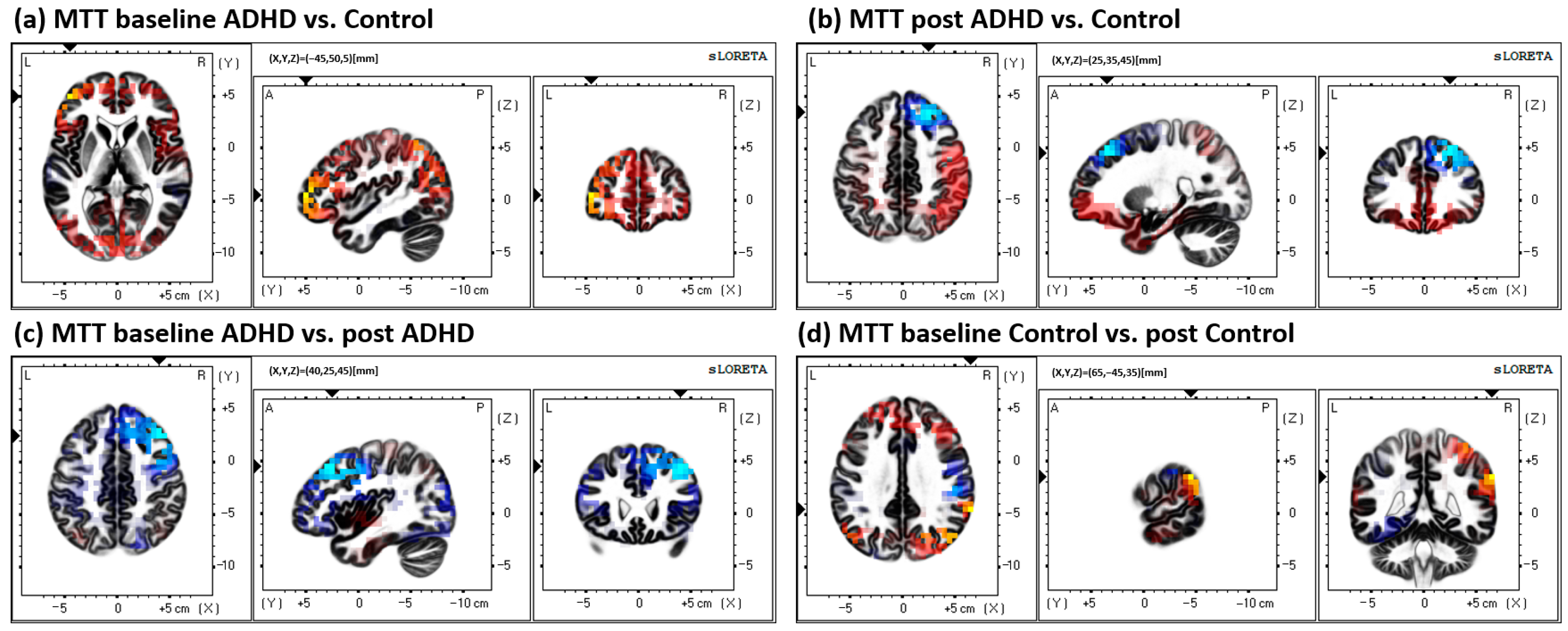 Brainsci 13 00370 g004