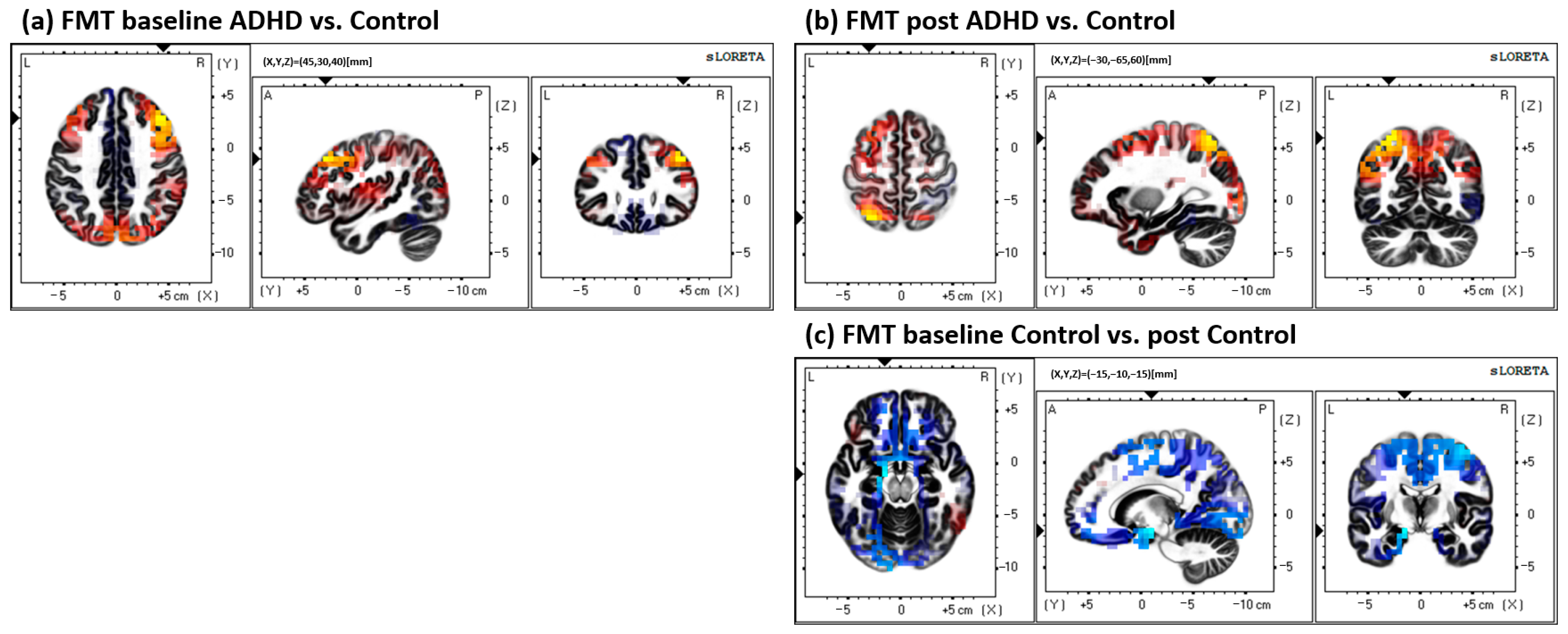 Brainsci 13 00370 g005