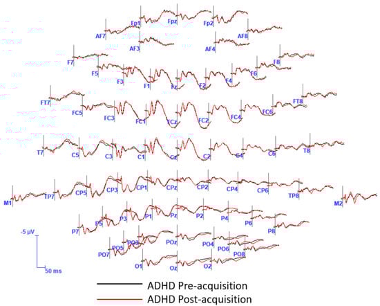Brainsci 13 00370 g0a1 Brainsci 13 00370 g0a1