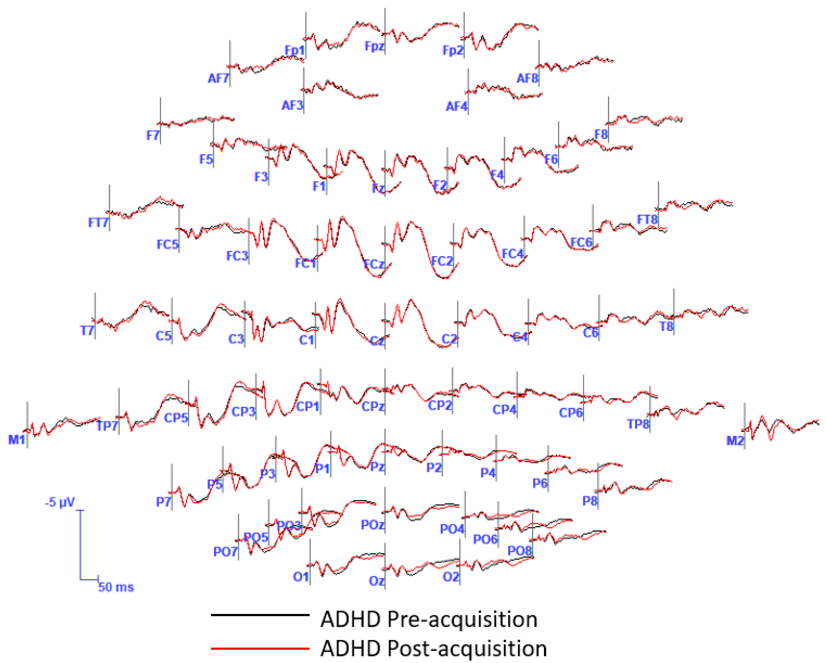 Brainsci 13 00370 g0a1