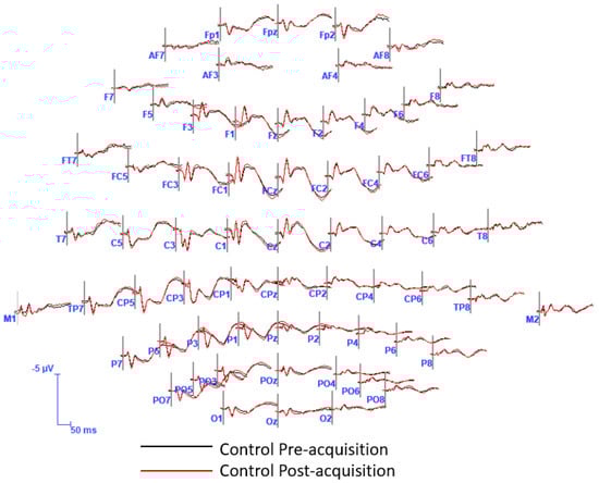 Brainsci 13 00370 g0a2 Brainsci 13 00370 g0a2