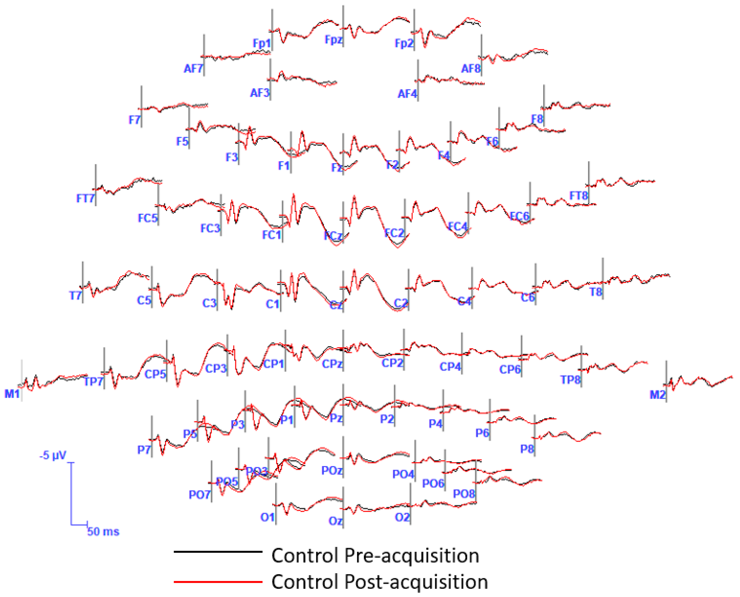 Brainsci 13 00370 g0a2