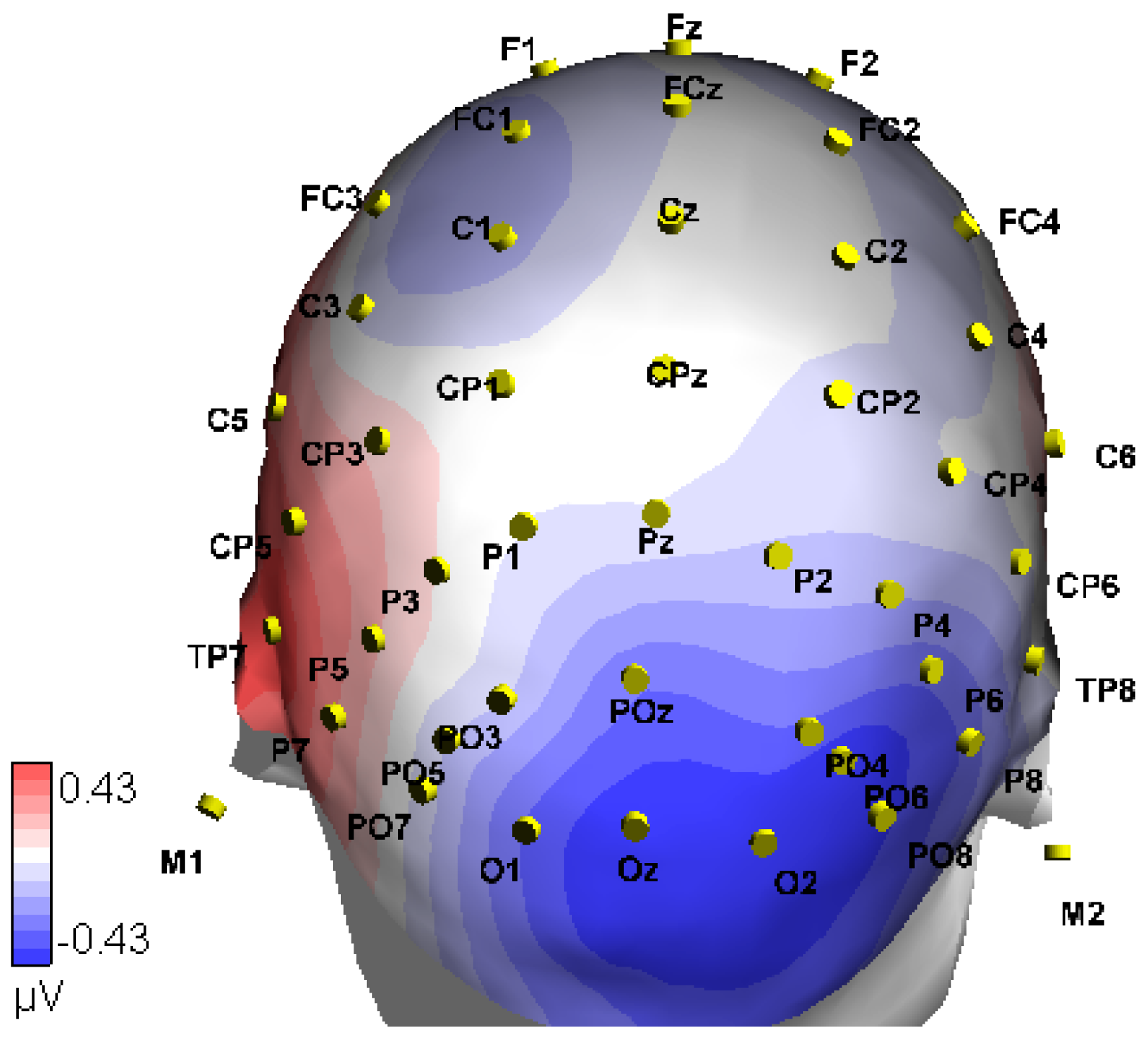 Brainsci 13 00370 g0a3