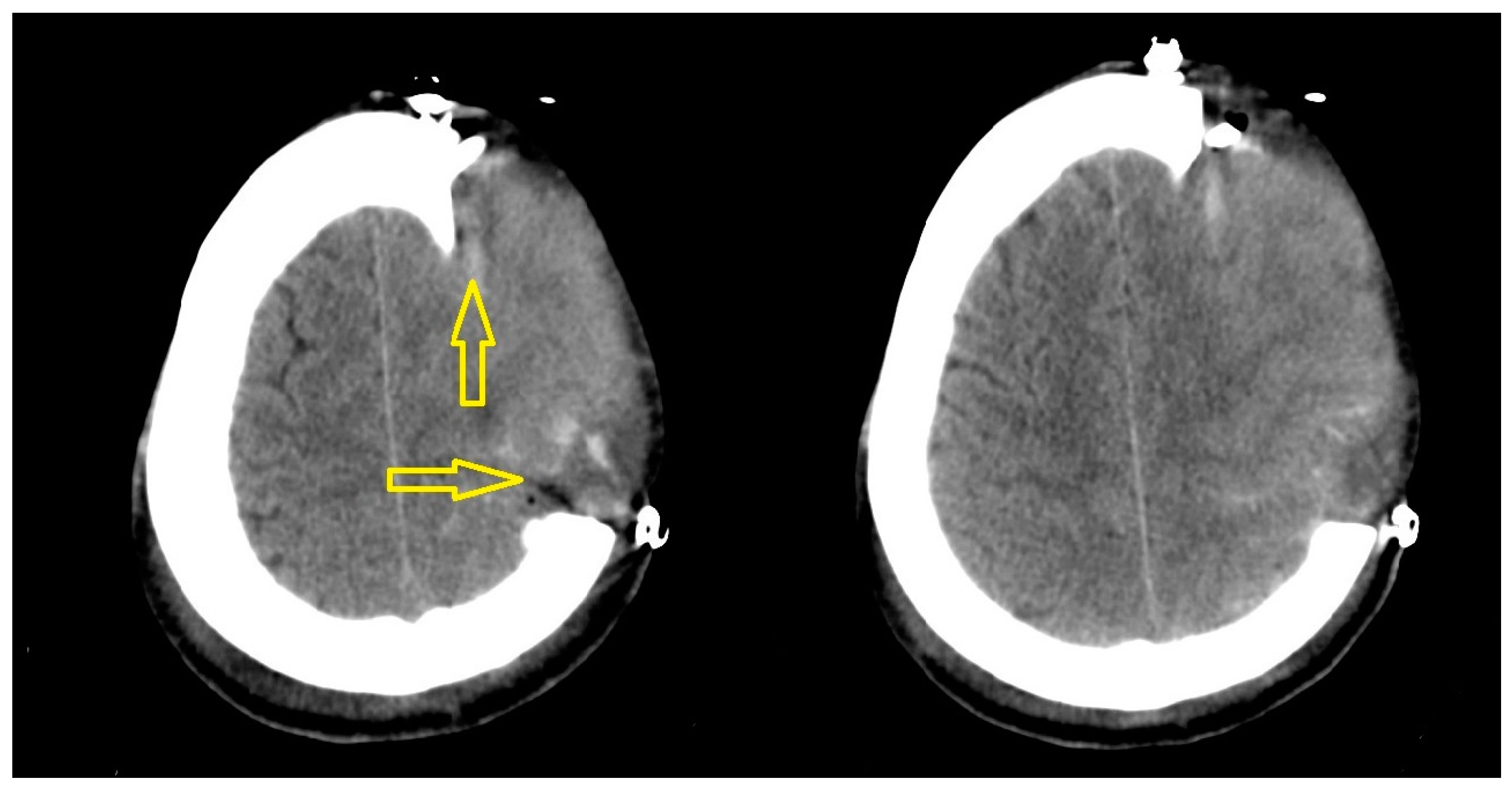 Brainsci 13 00371 g003