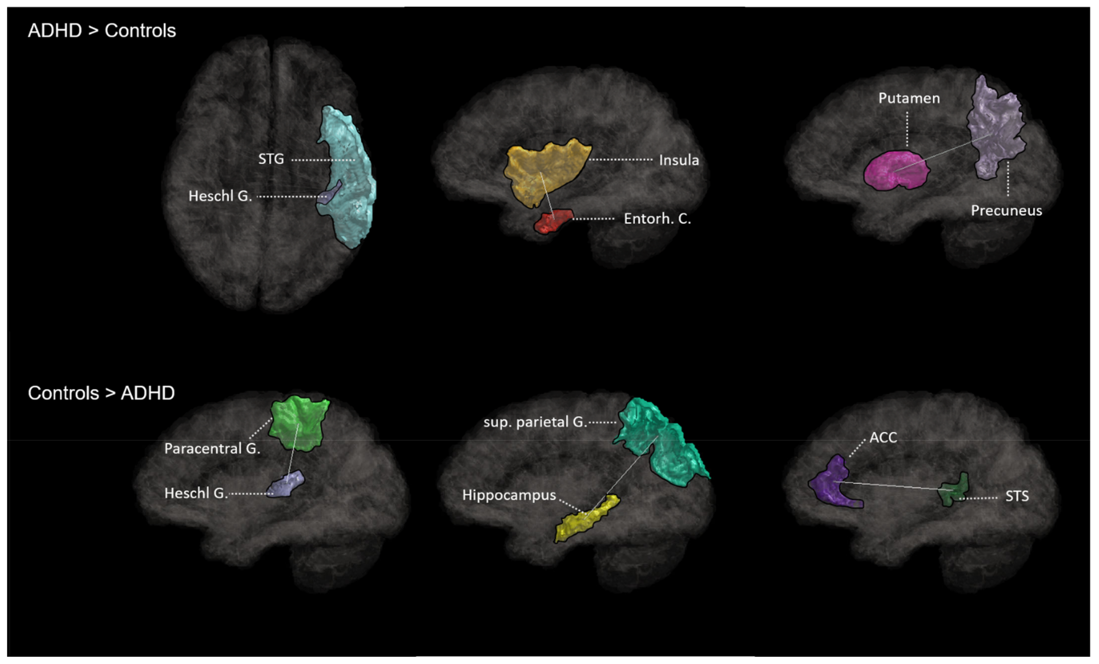 Brainsci 13 00388 g002 Brainsci 13 00388 g002