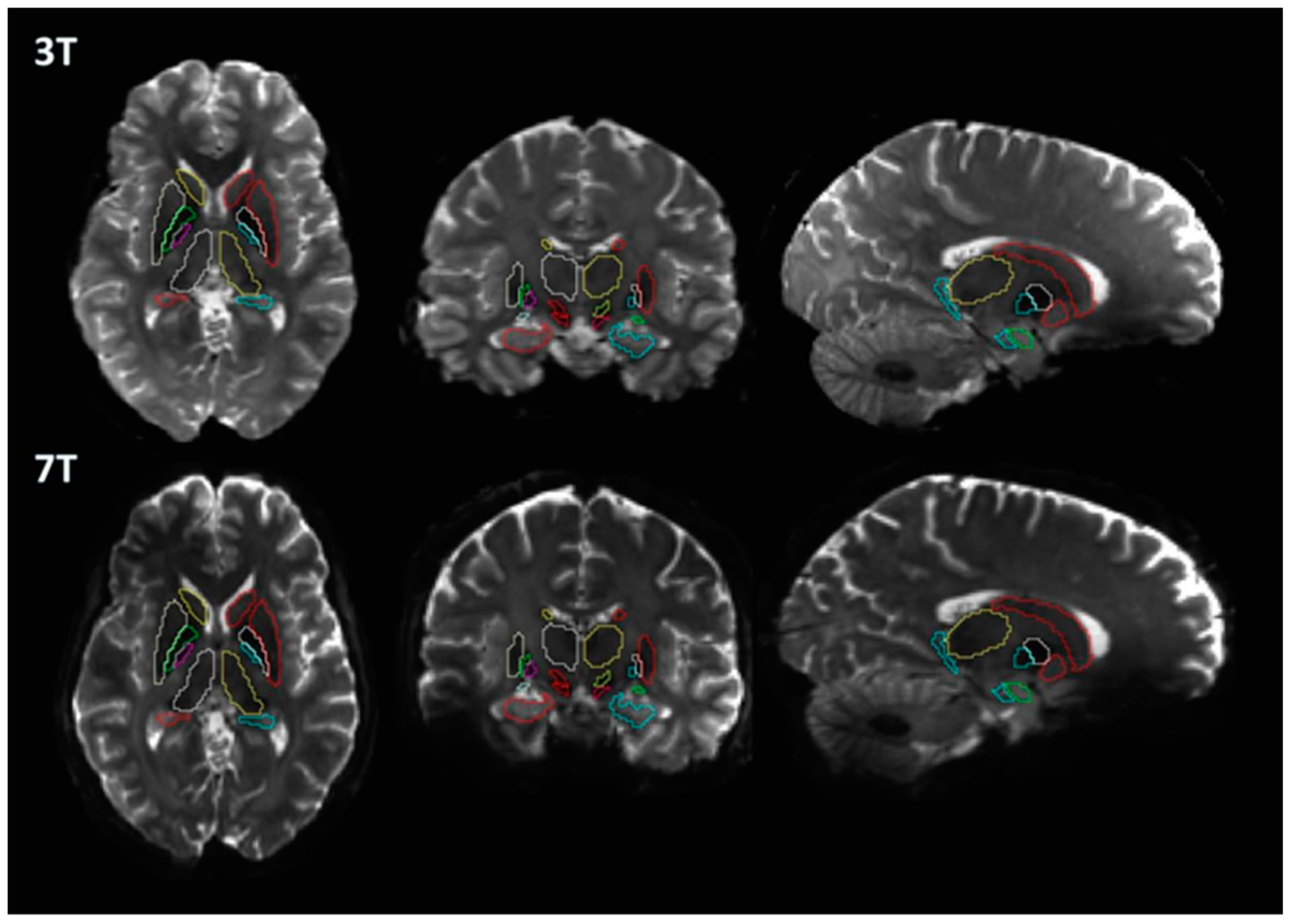 Brainsci 13 00391 g003