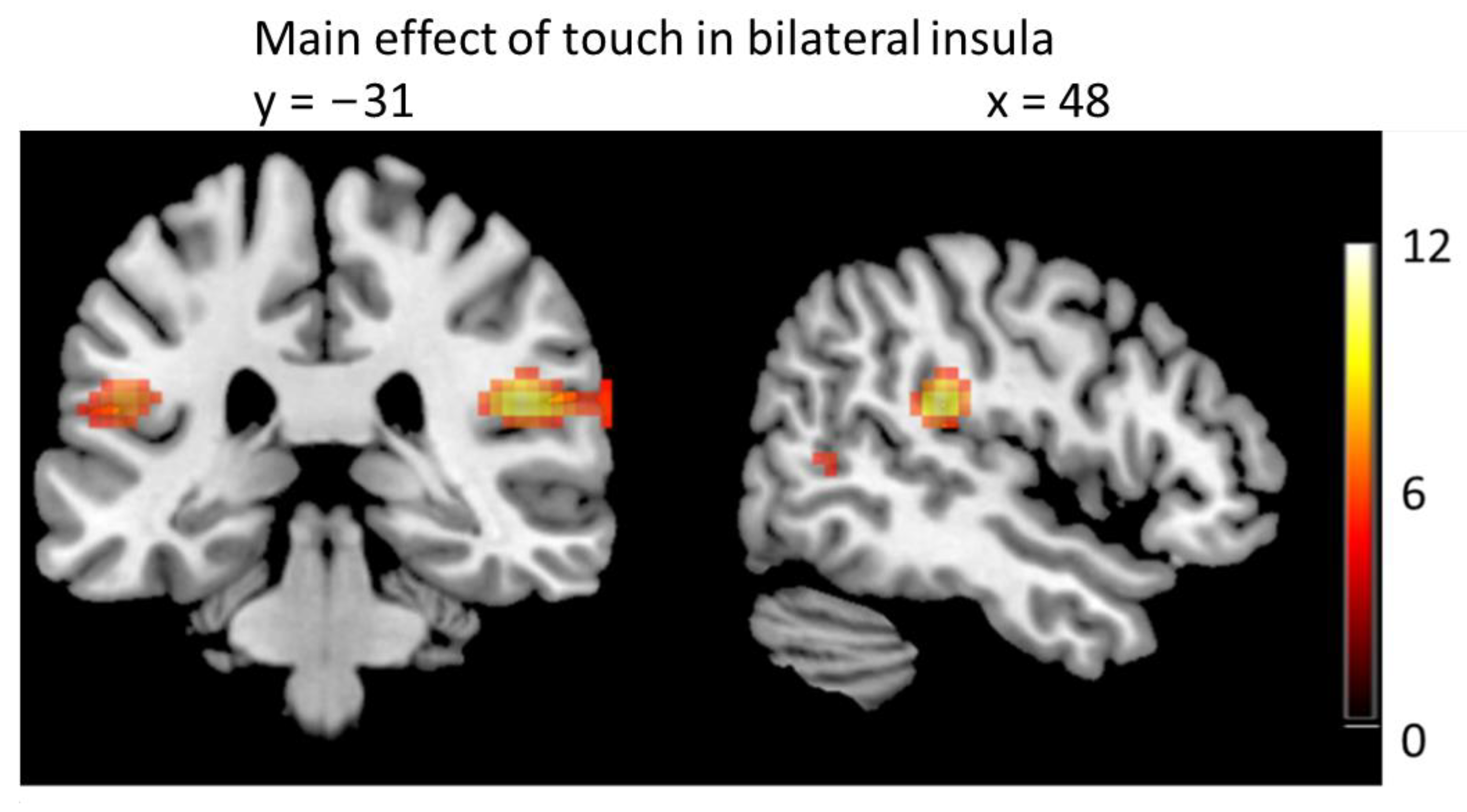 Brainsci 13 00393 g003