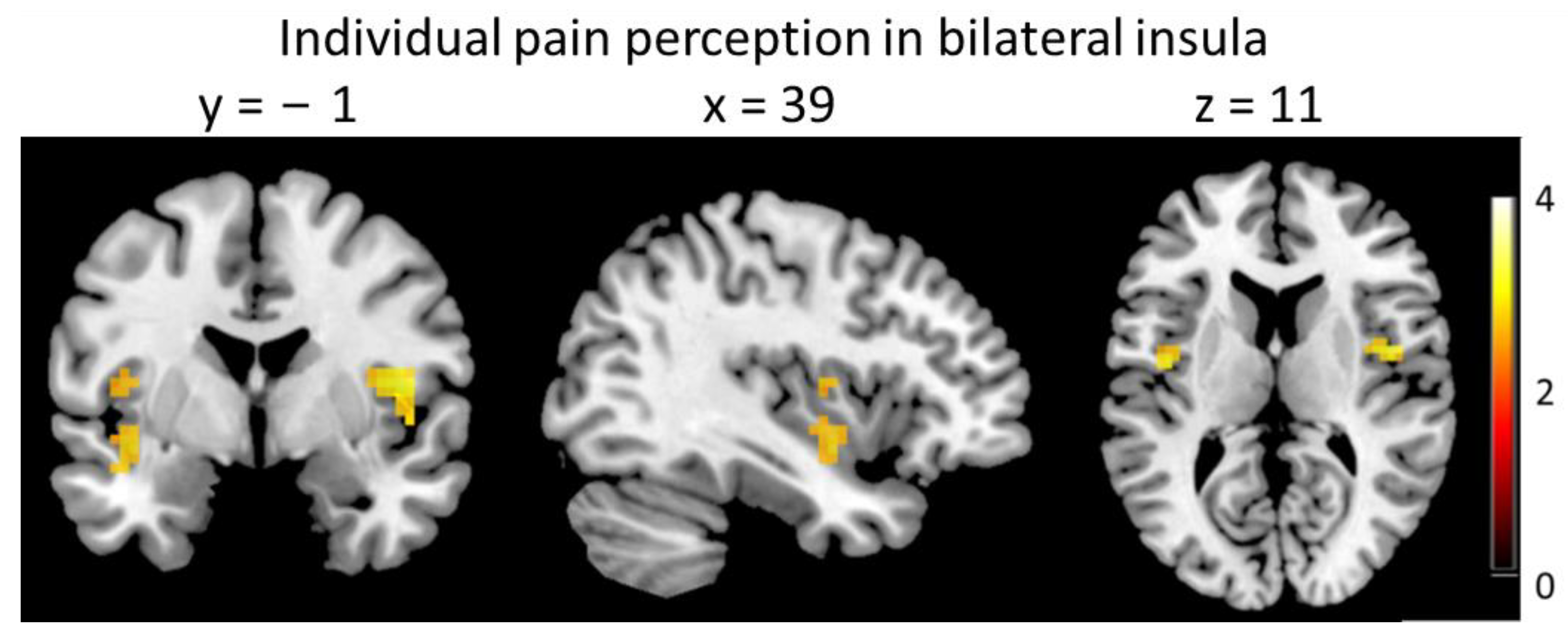 Brainsci 13 00393 g005