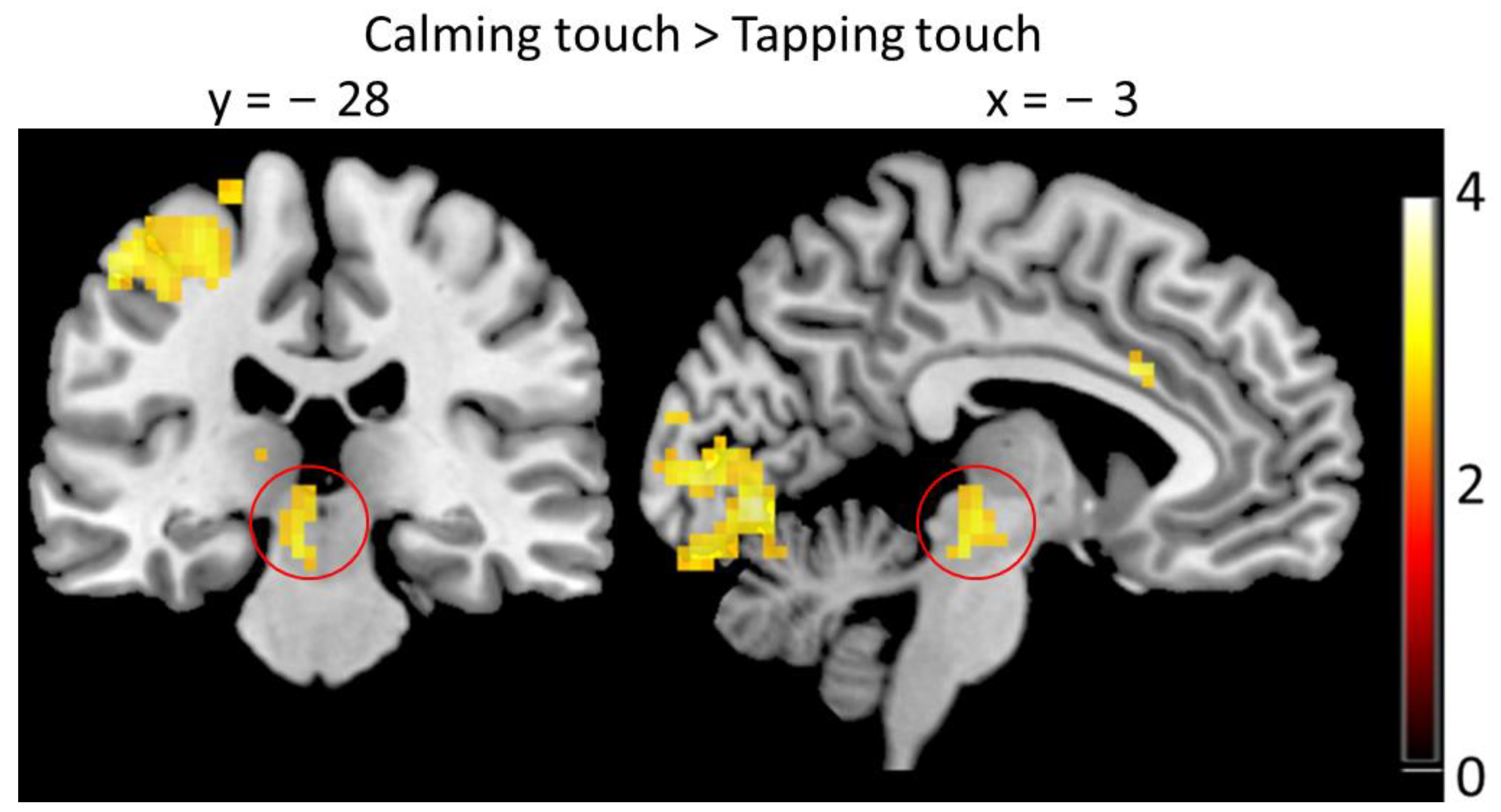 Brainsci 13 00393 g006