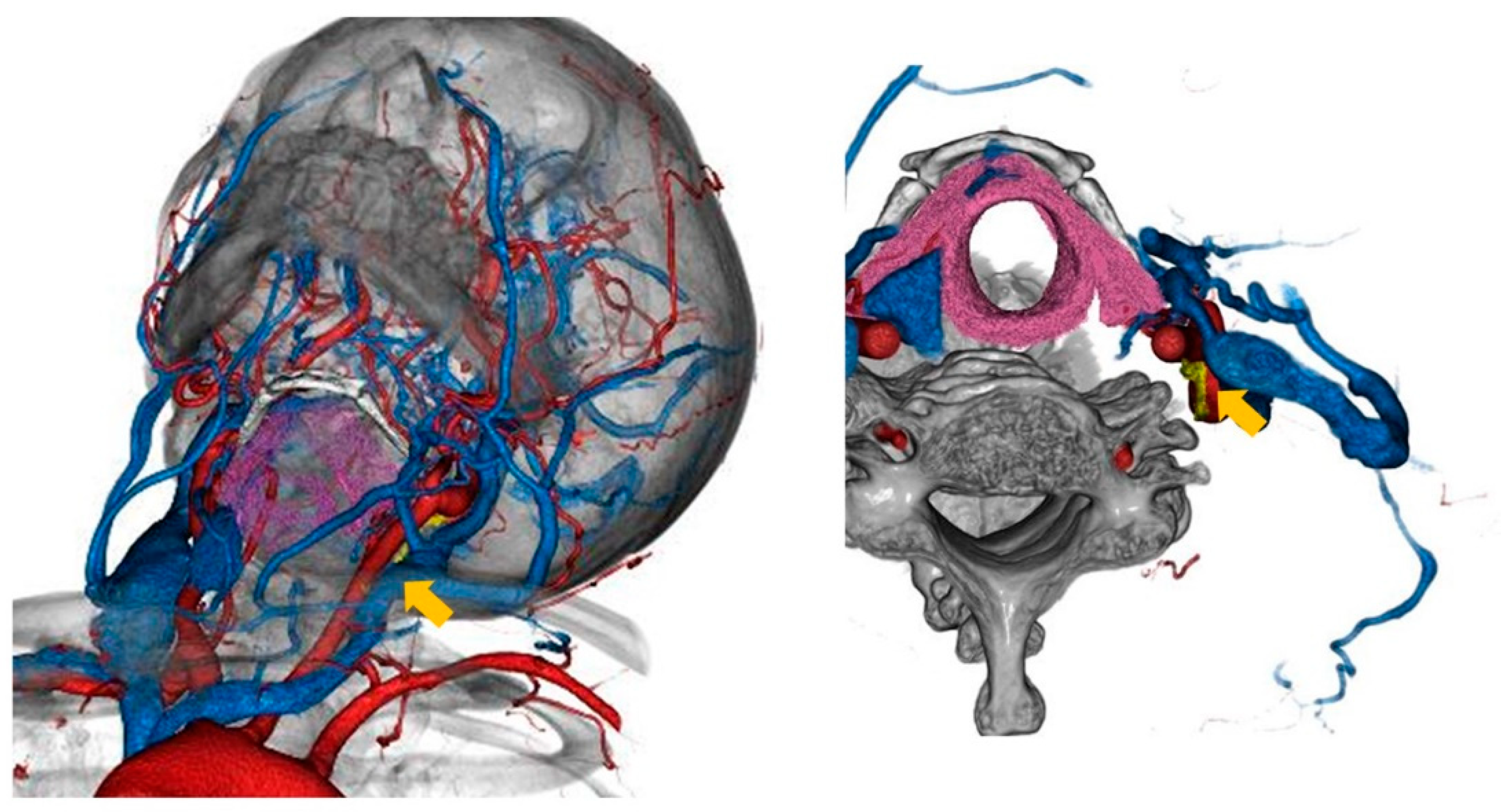 Brainsci 13 00396 g002 Brainsci 13 00396 g002