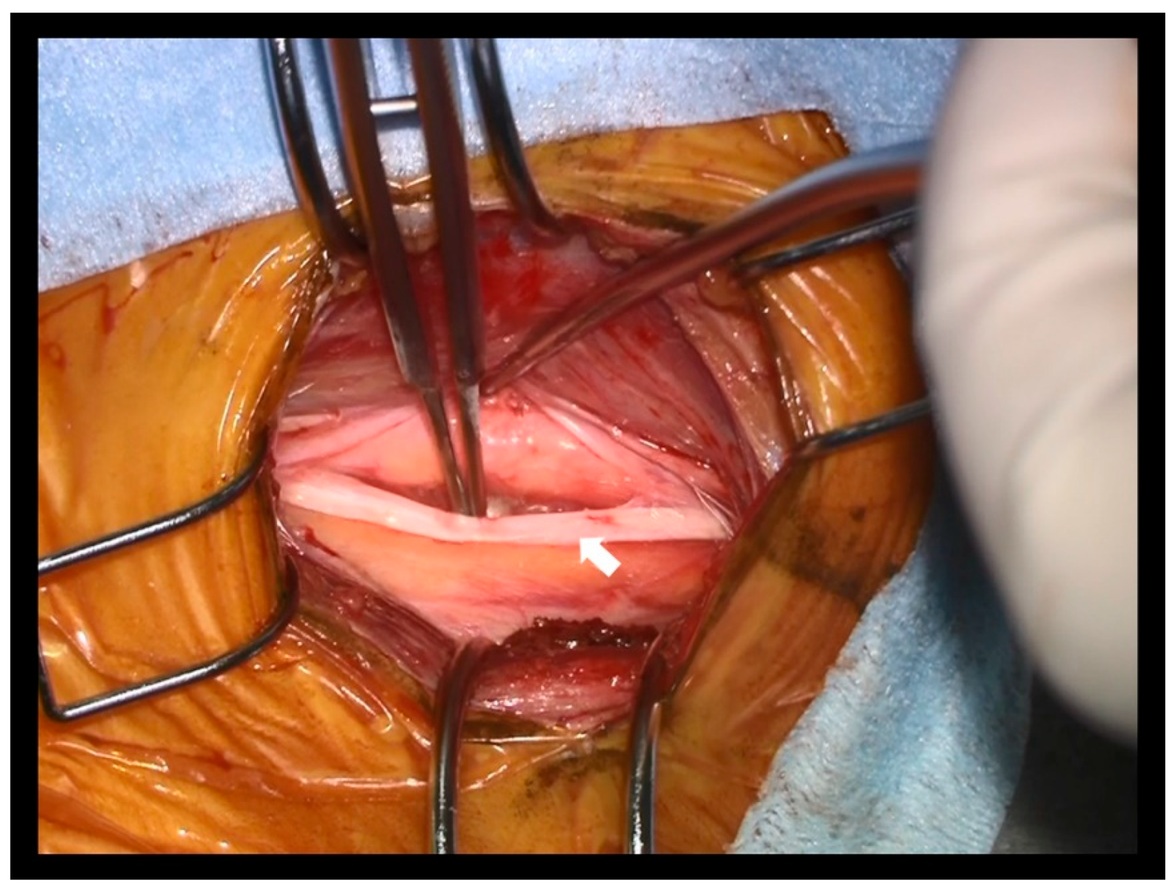 Brainsci 13 00396 g004 Brainsci 13 00396 g004