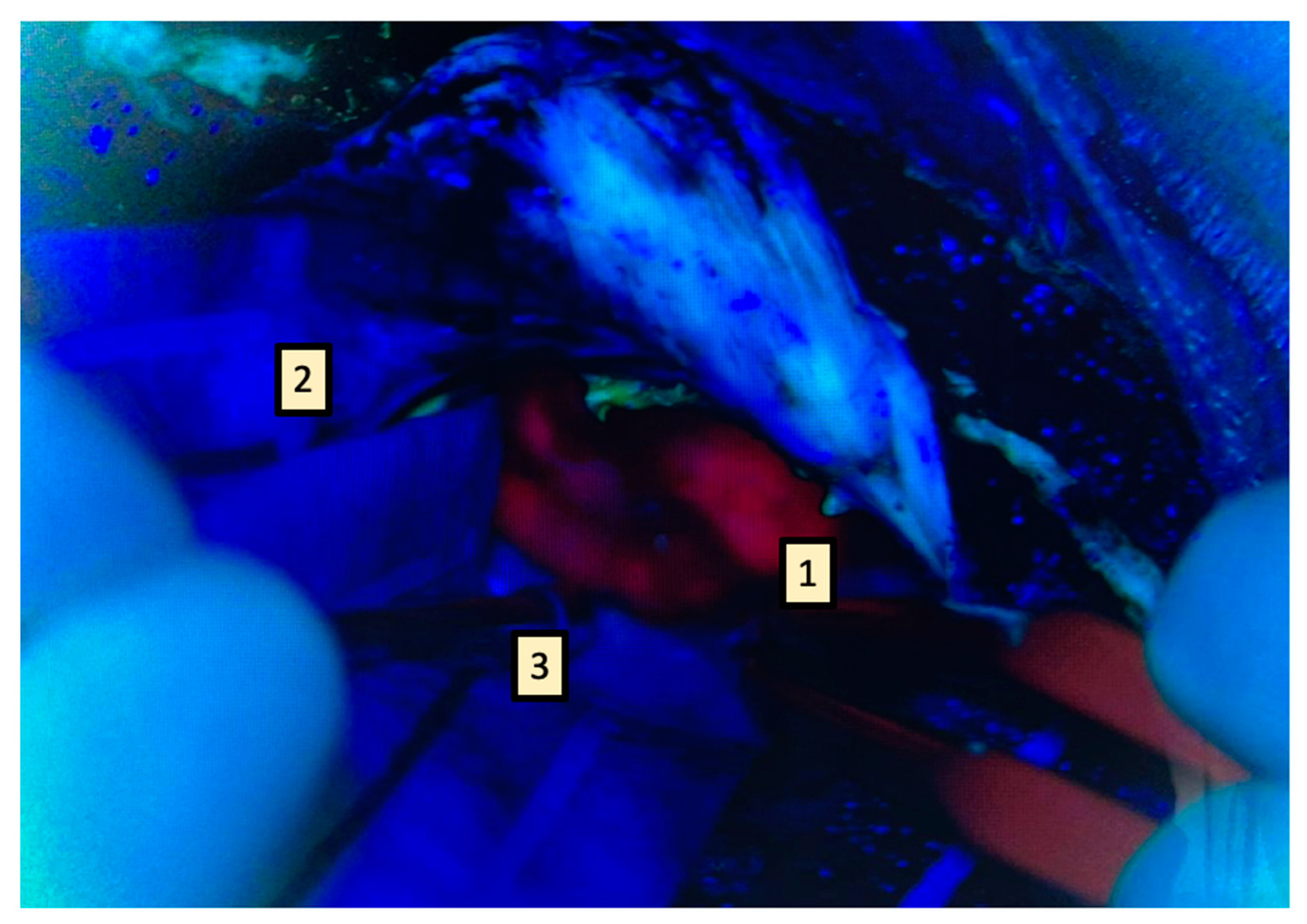 Brainsci 13 00411 g003