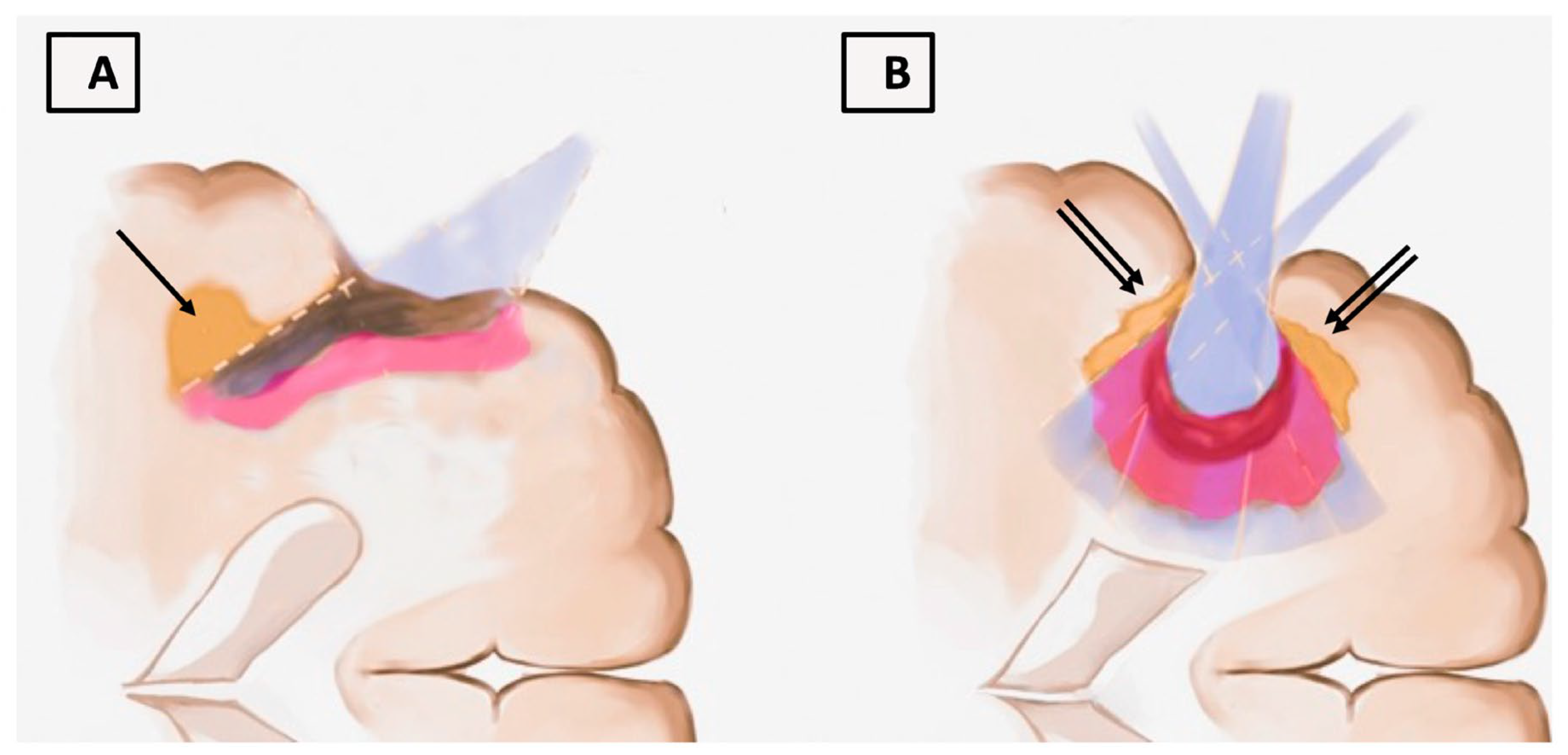 Brainsci 13 00411 g004
