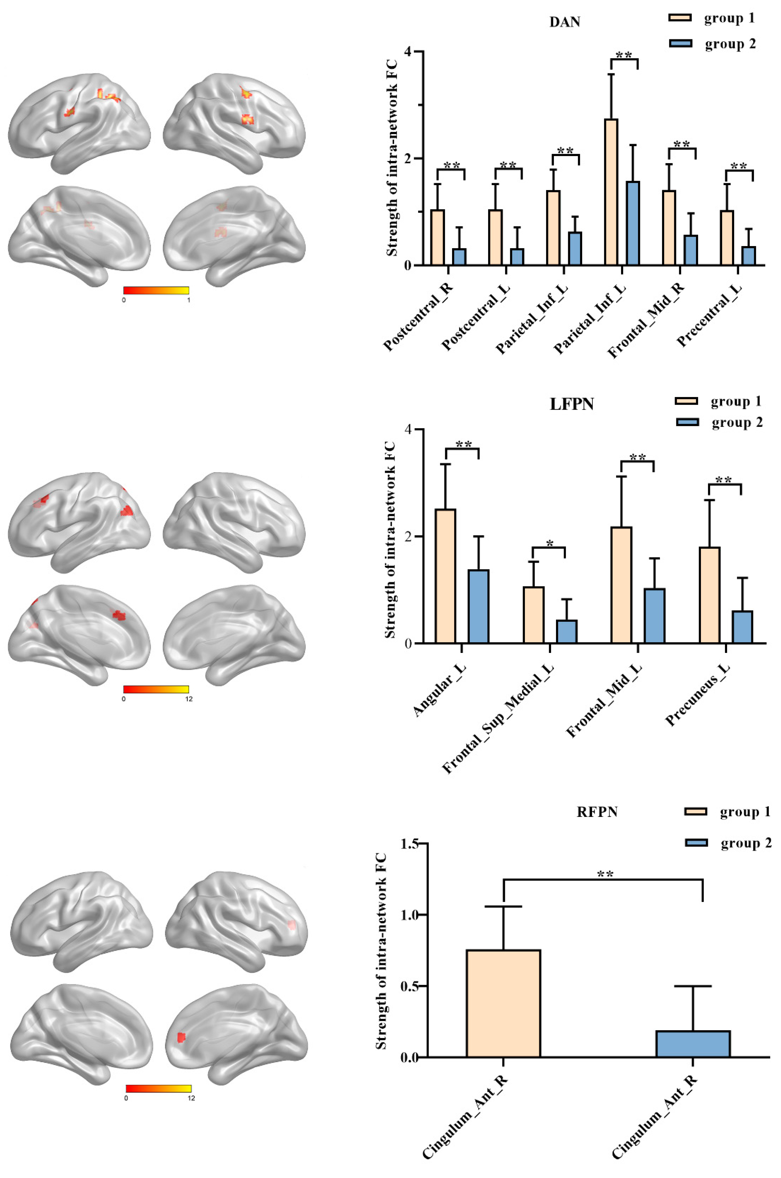 Brainsci 13 00419 g004