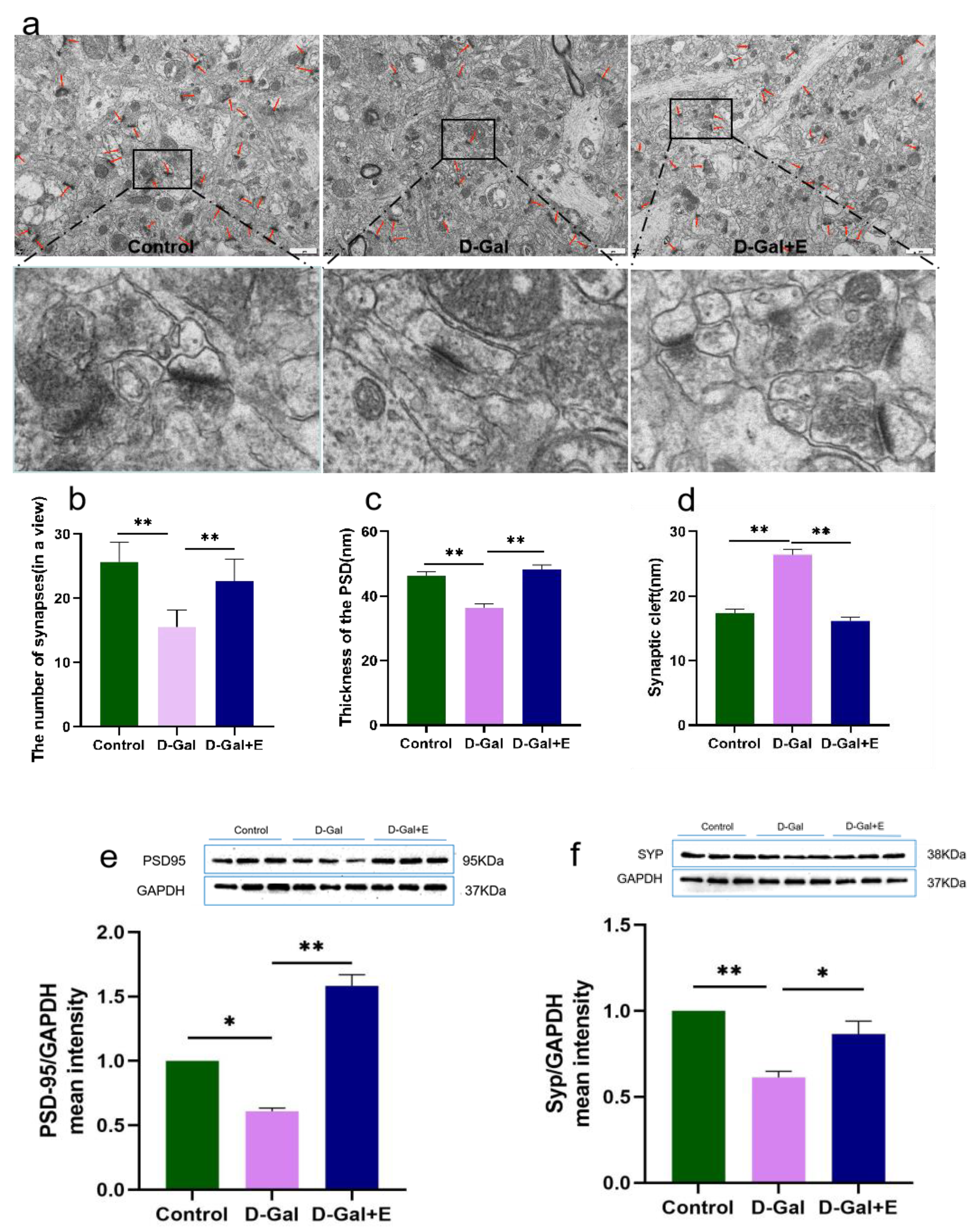 Brainsci 13 00422 g002
