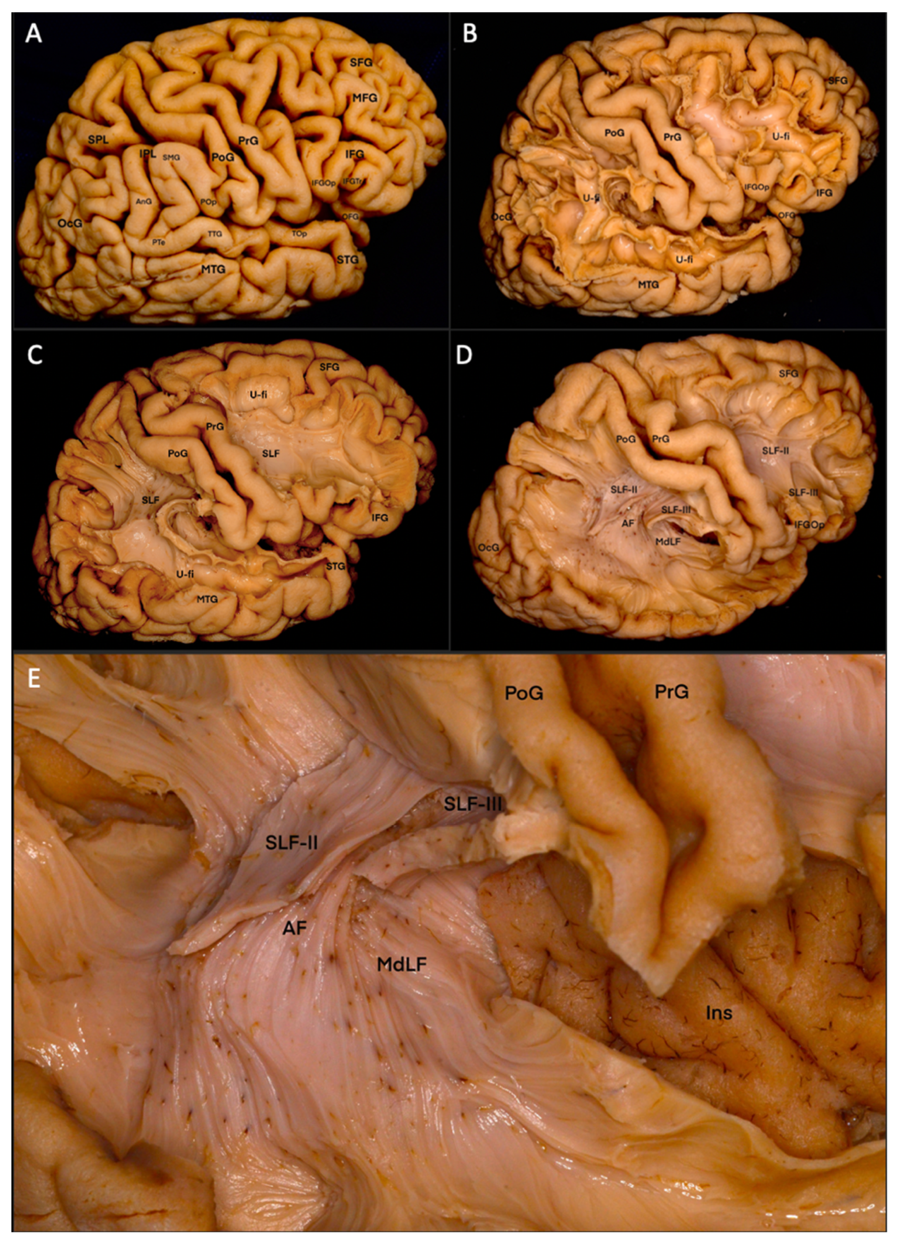 Brainsci 13 00430 g001