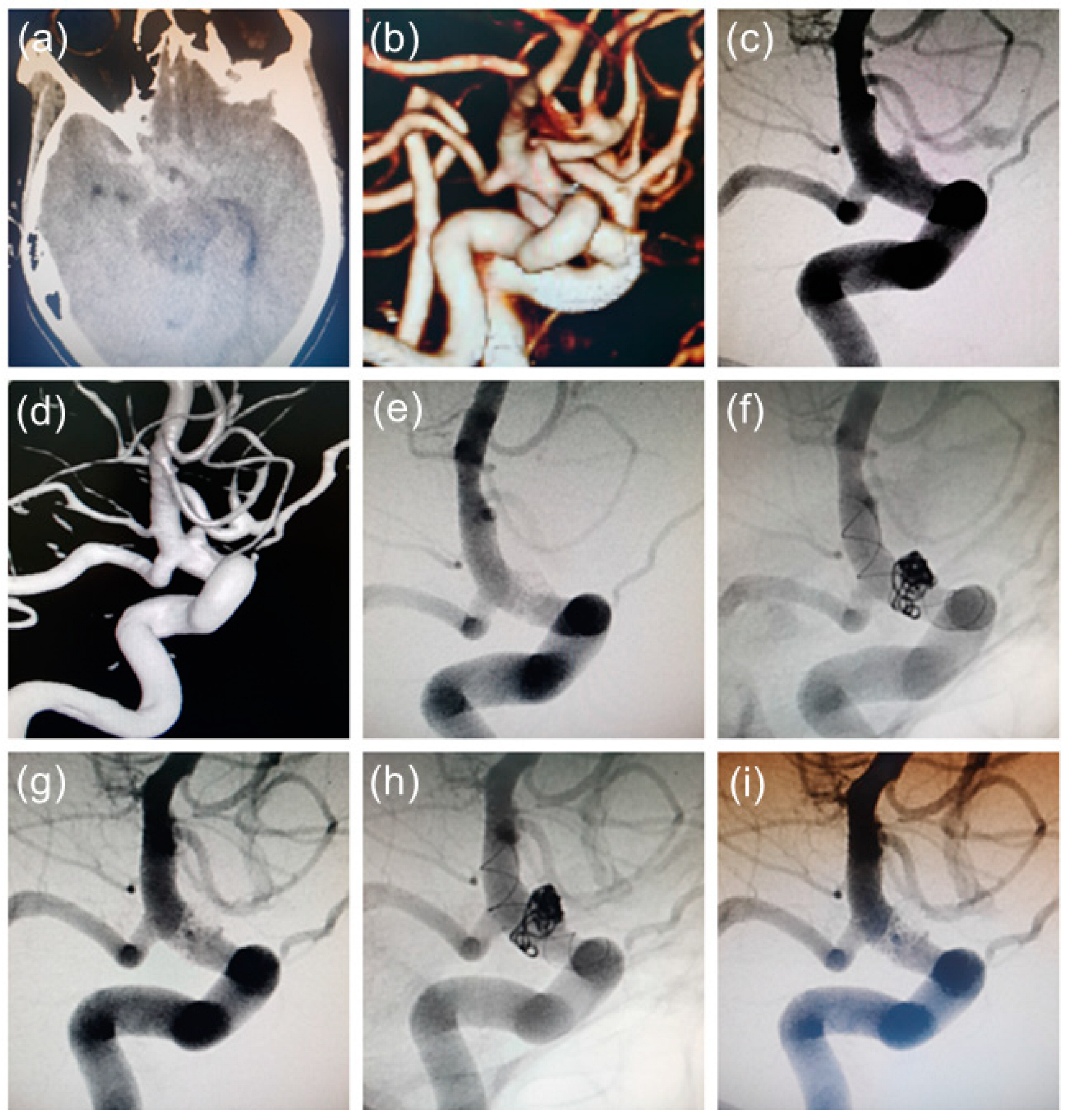 Brainsci 13 00435 g002