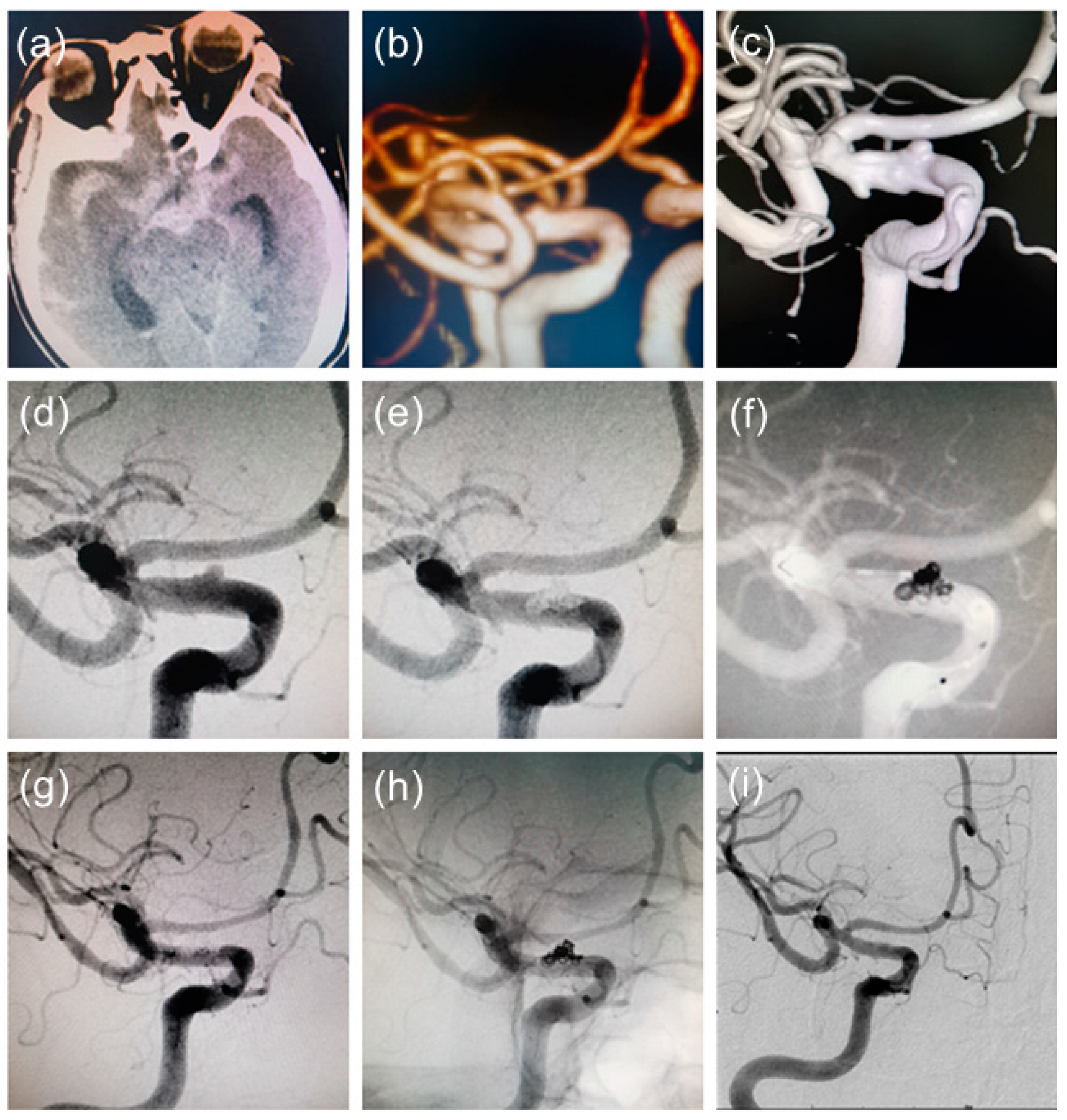 Brainsci 13 00435 g003