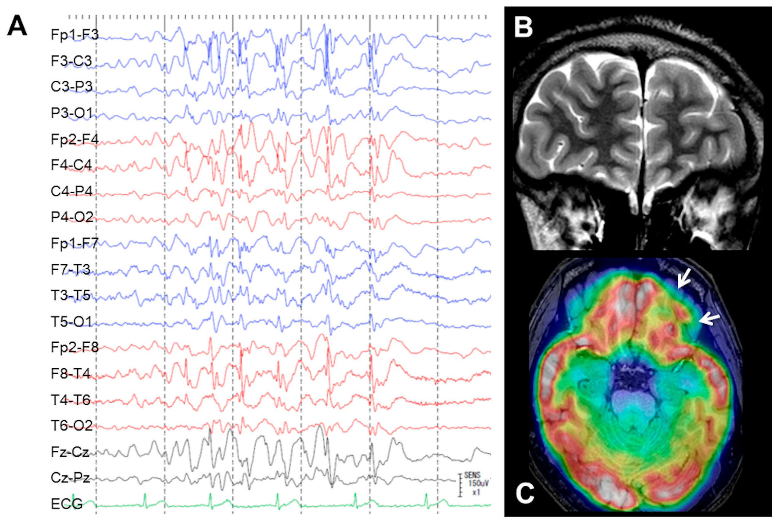 Brainsci 13 00440 g001
