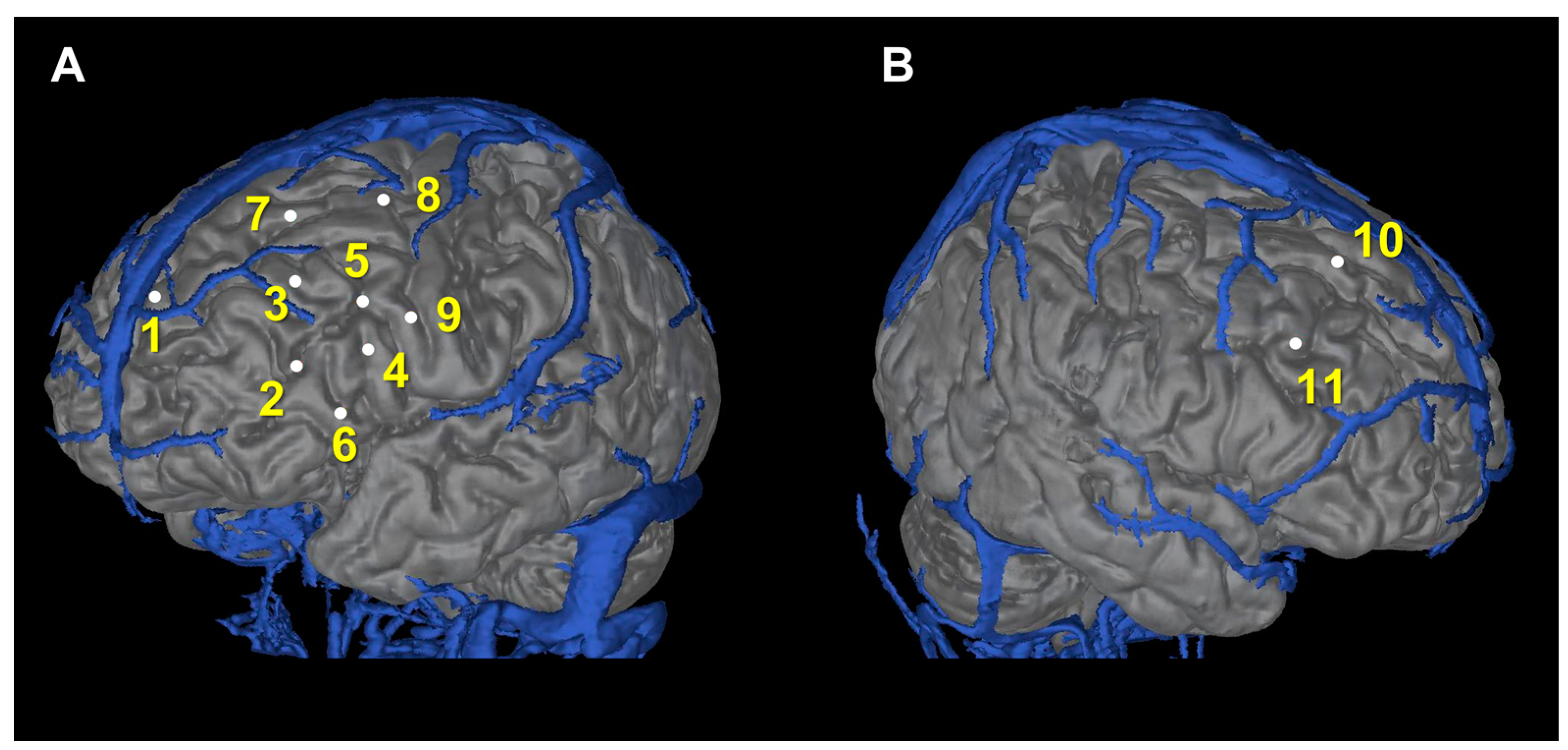 Brainsci 13 00440 g002