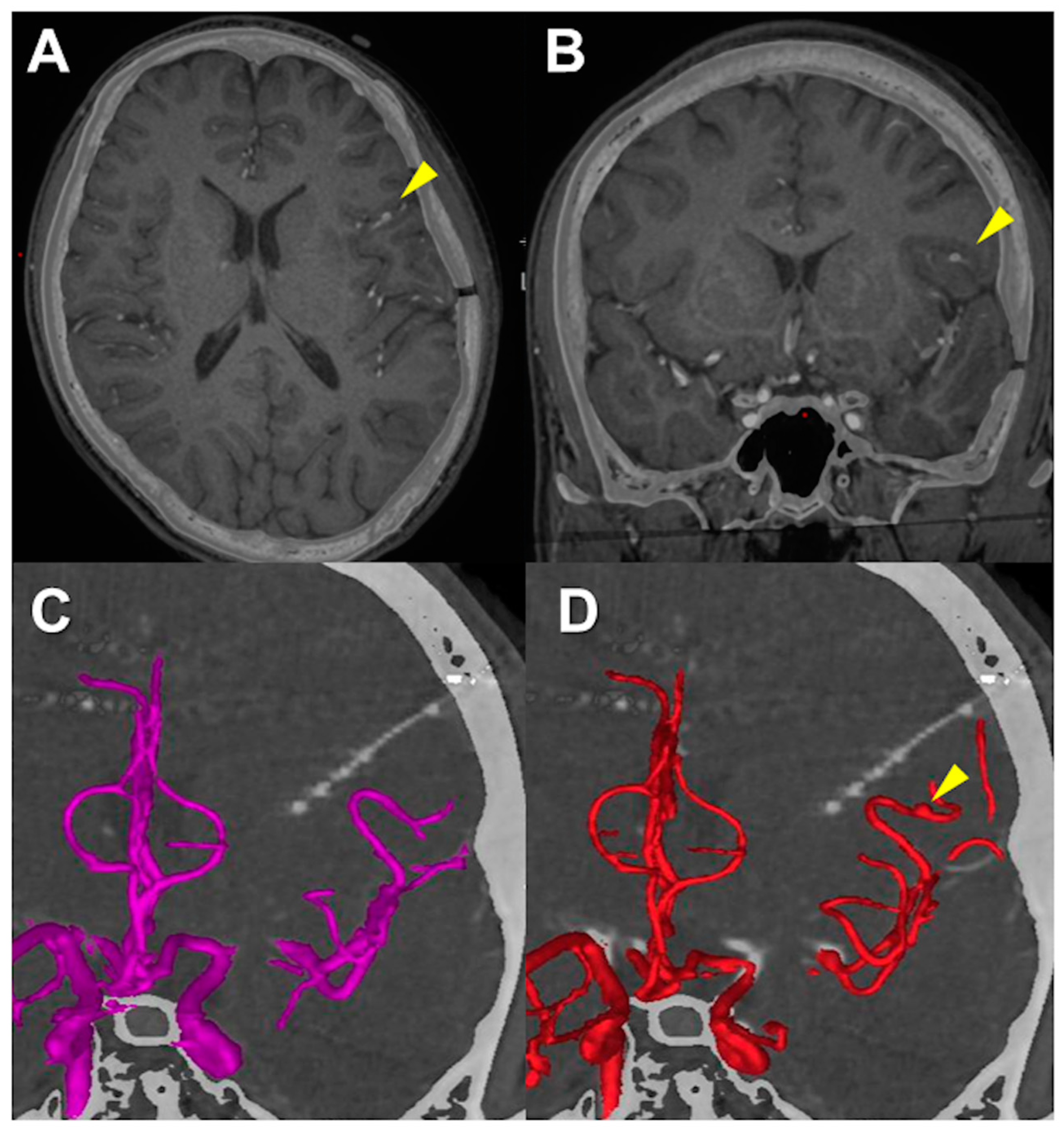 Brainsci 13 00440 g005