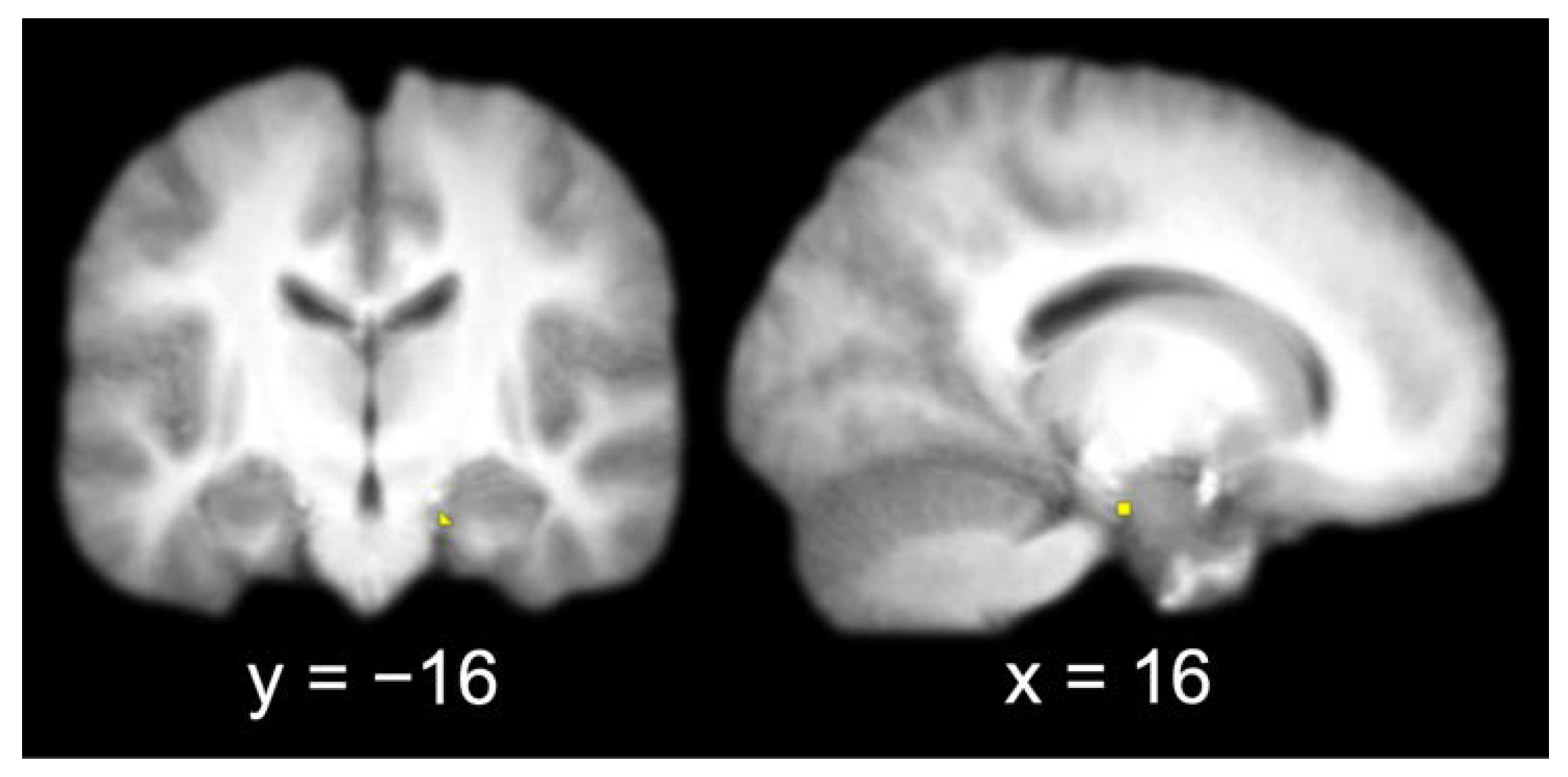 Brainsci 13 00446 g003