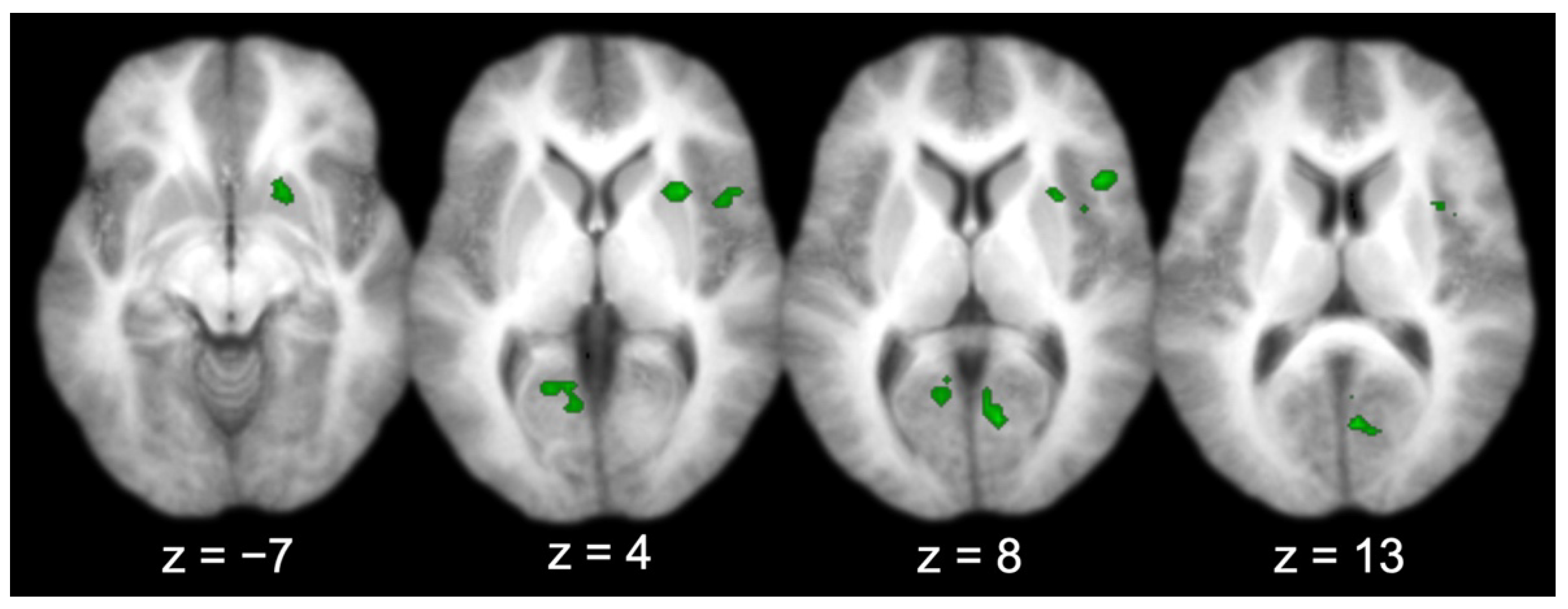 Brainsci 13 00446 g004