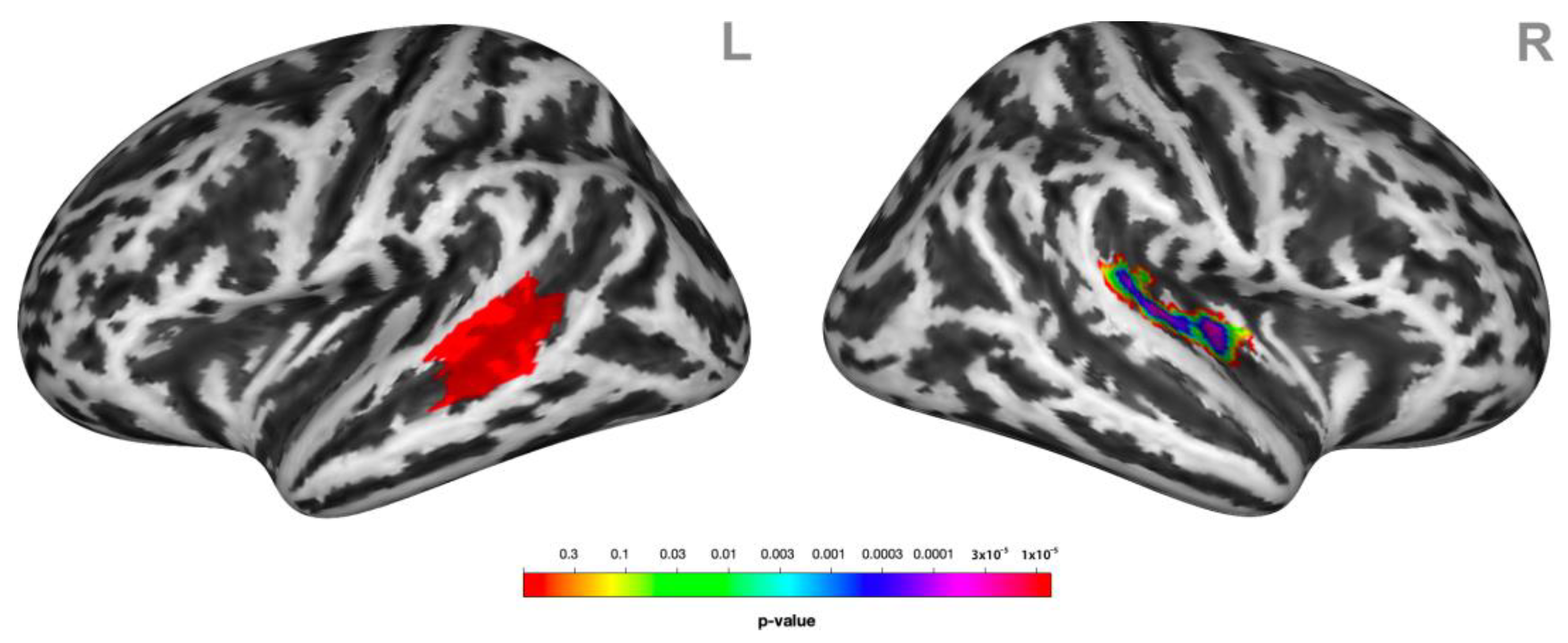 Brainsci 13 00474 g004