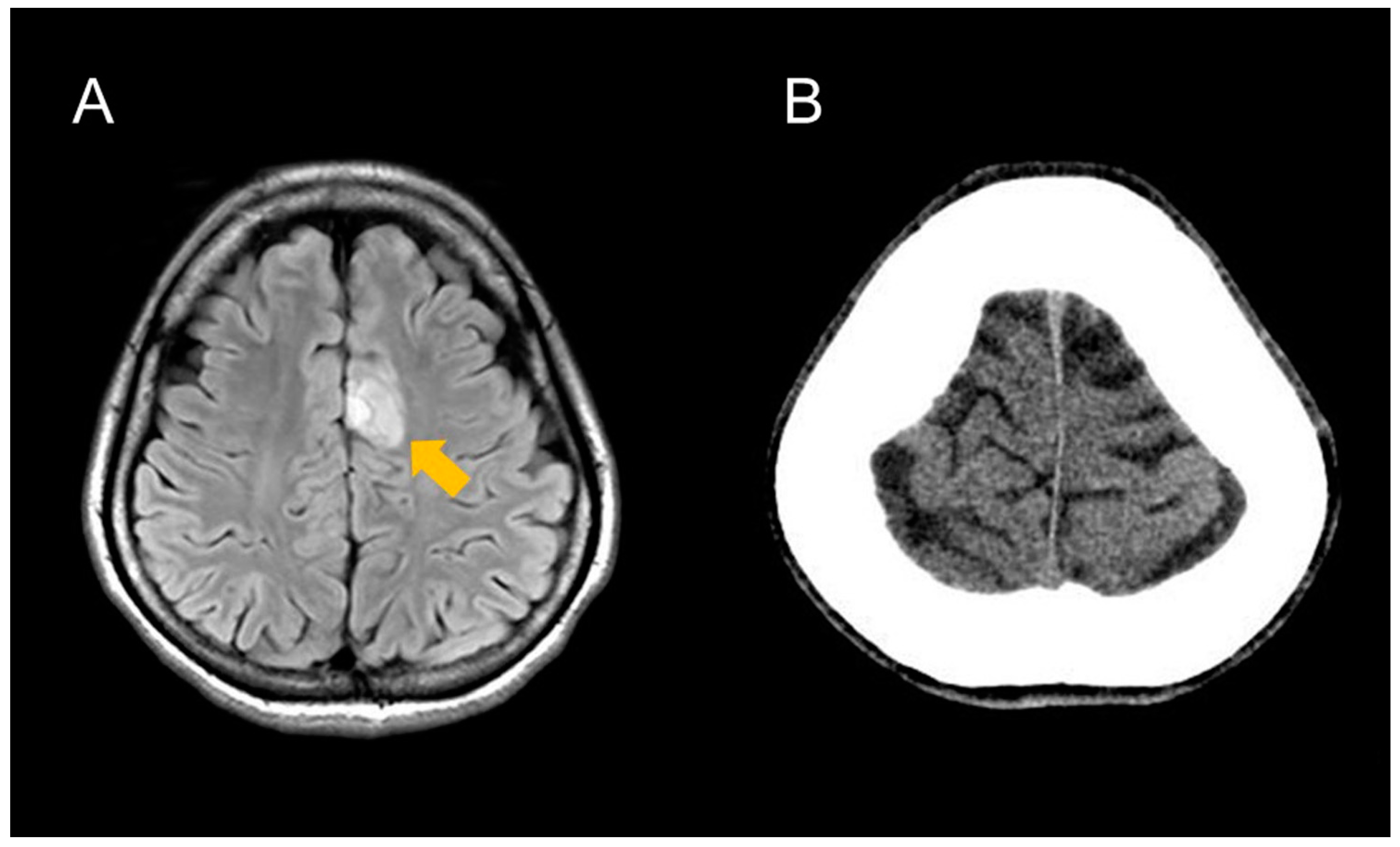 Brainsci 13 00482 g001