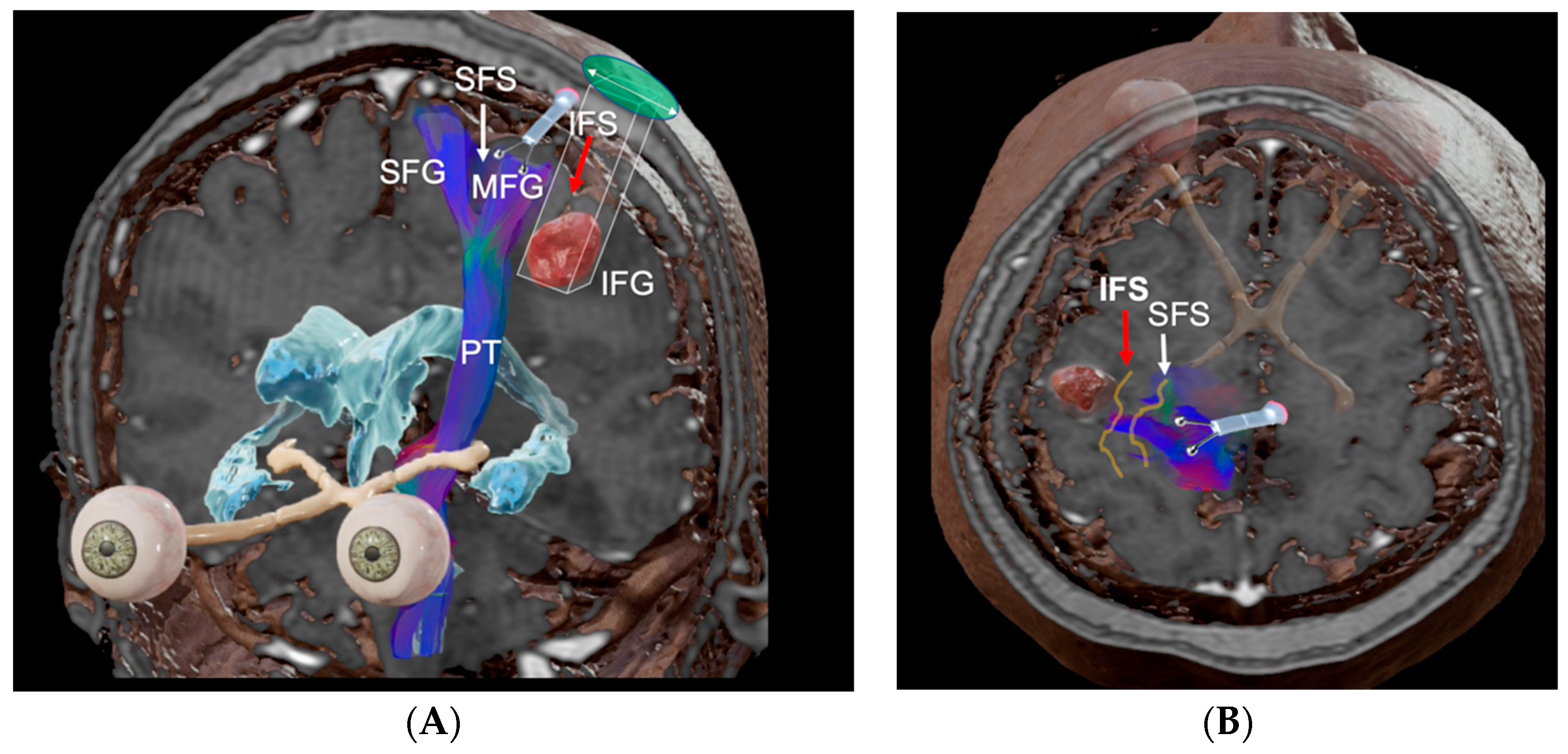 Brainsci 13 00498 g004