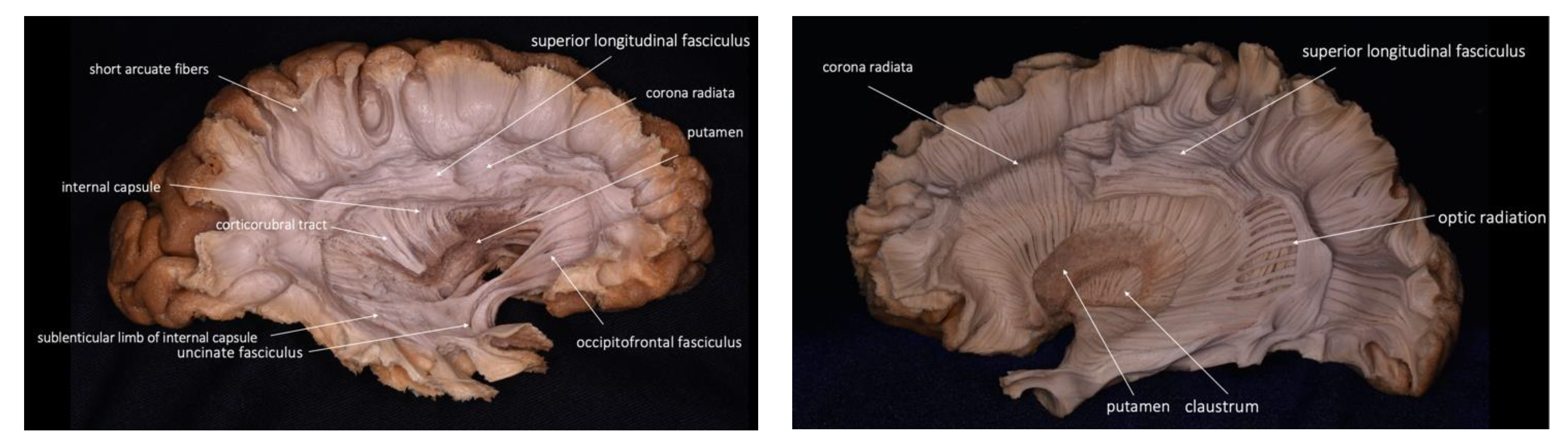 Brainsci 13 00498 g006